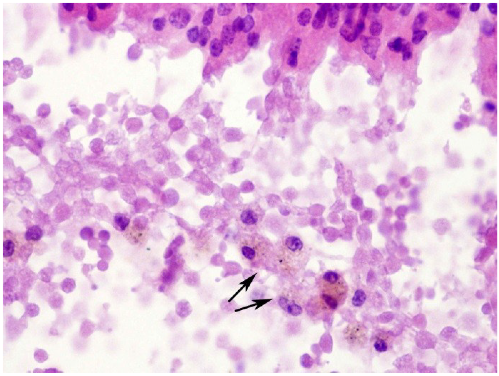 Toxins 07 00367 g005 1024