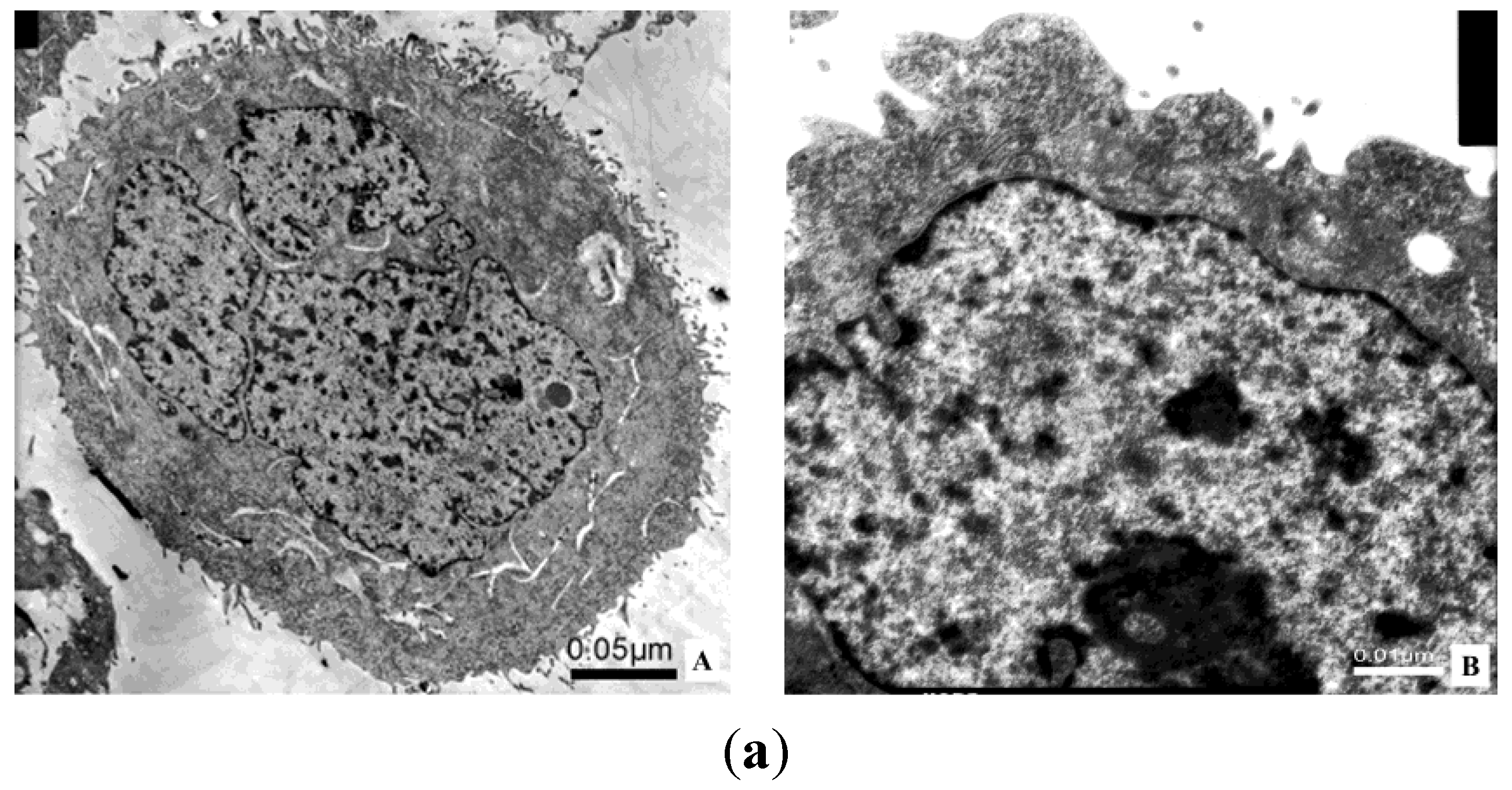 Toxins 07 00423 g009a 1024