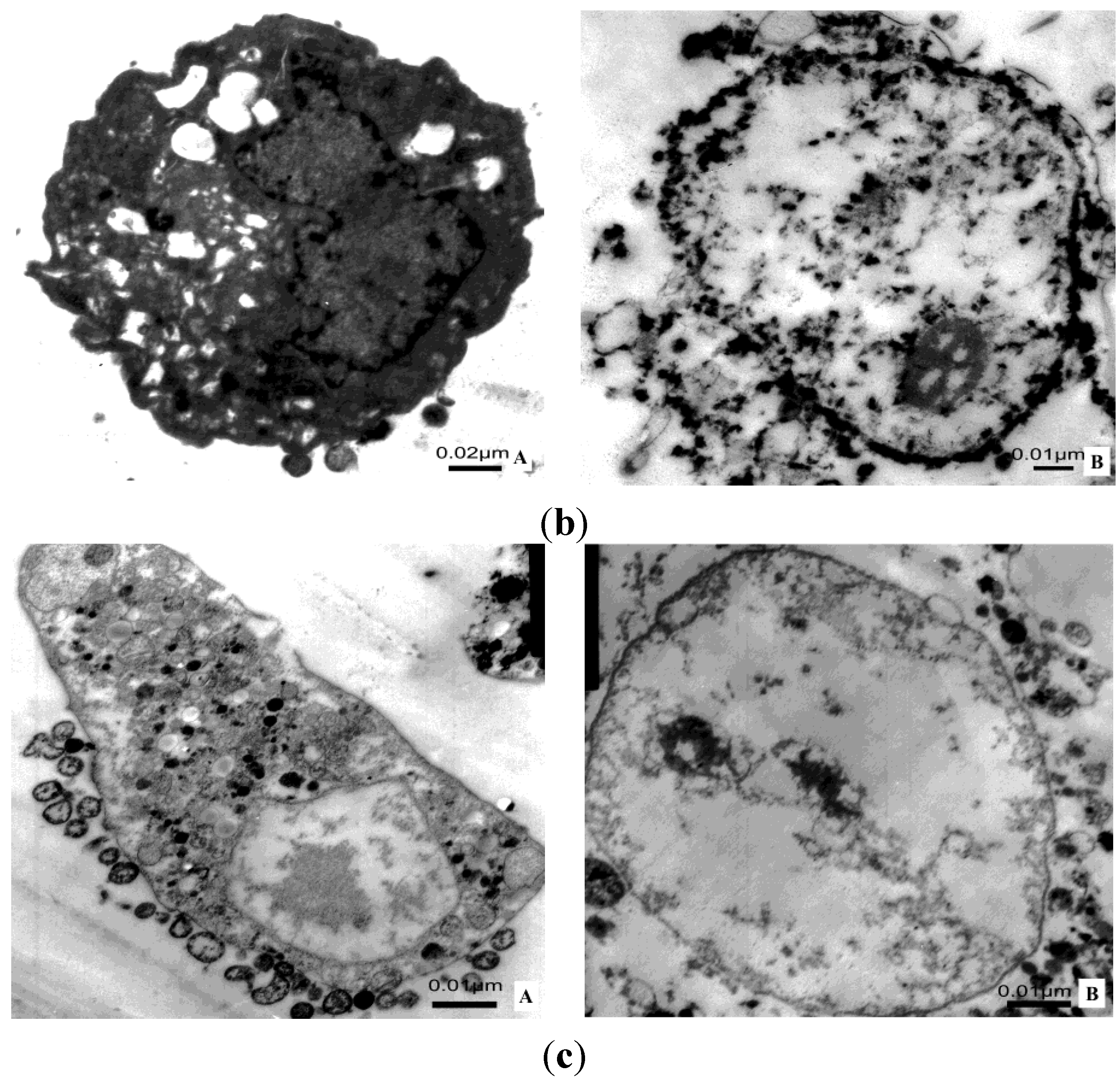 Toxins 07 00423 g009b 1024