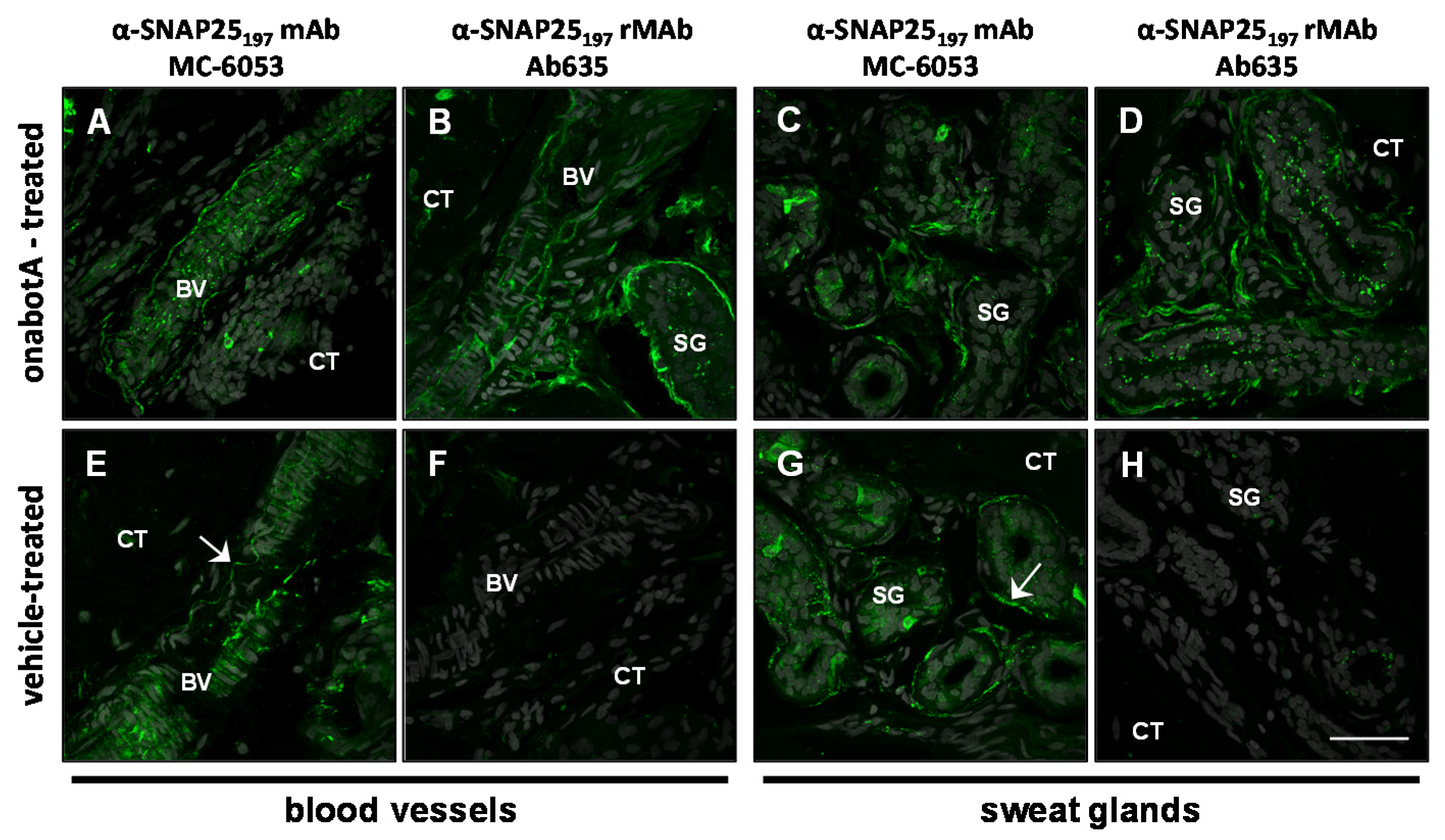 Toxins 07 02354 g004