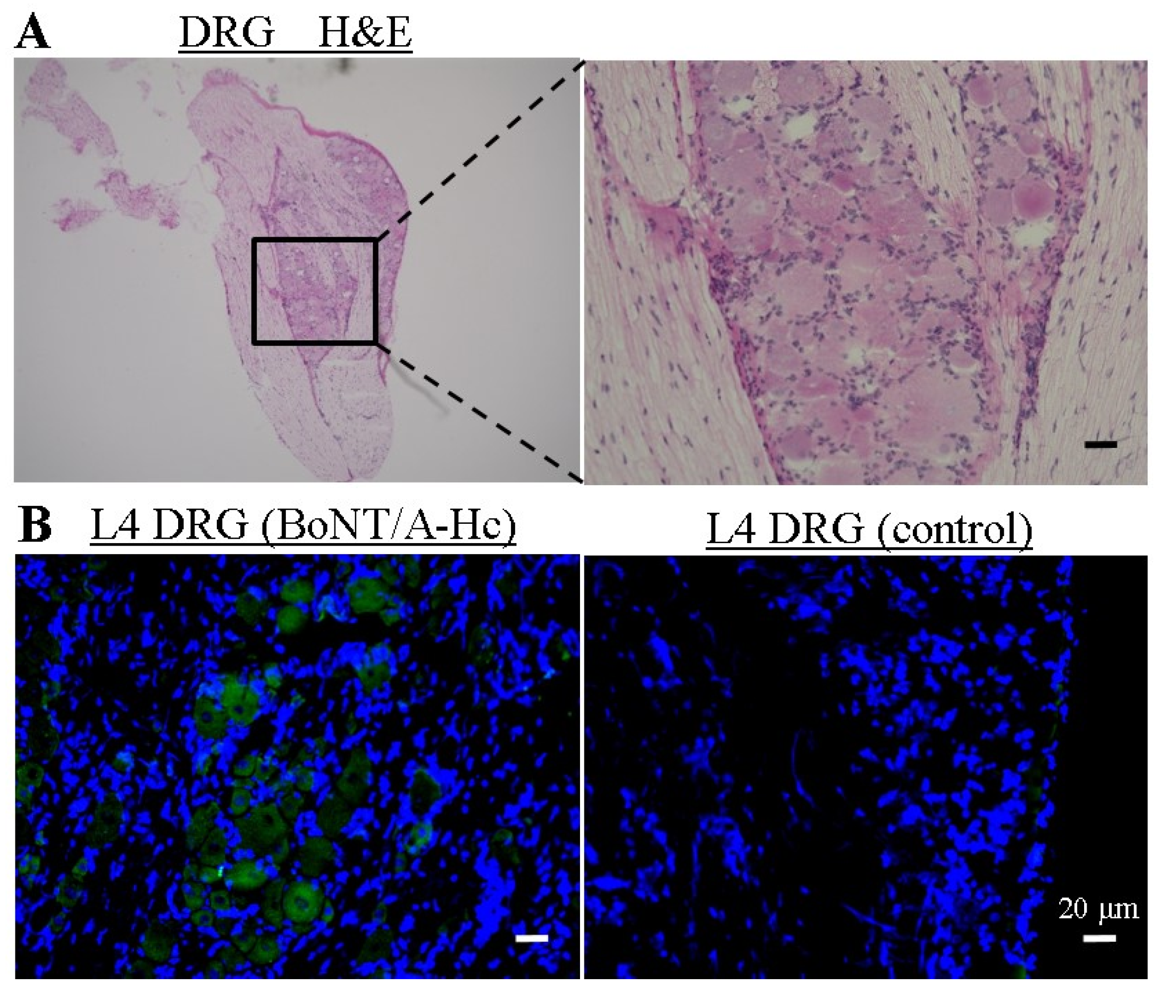 Toxins 07 02906 g004 1024