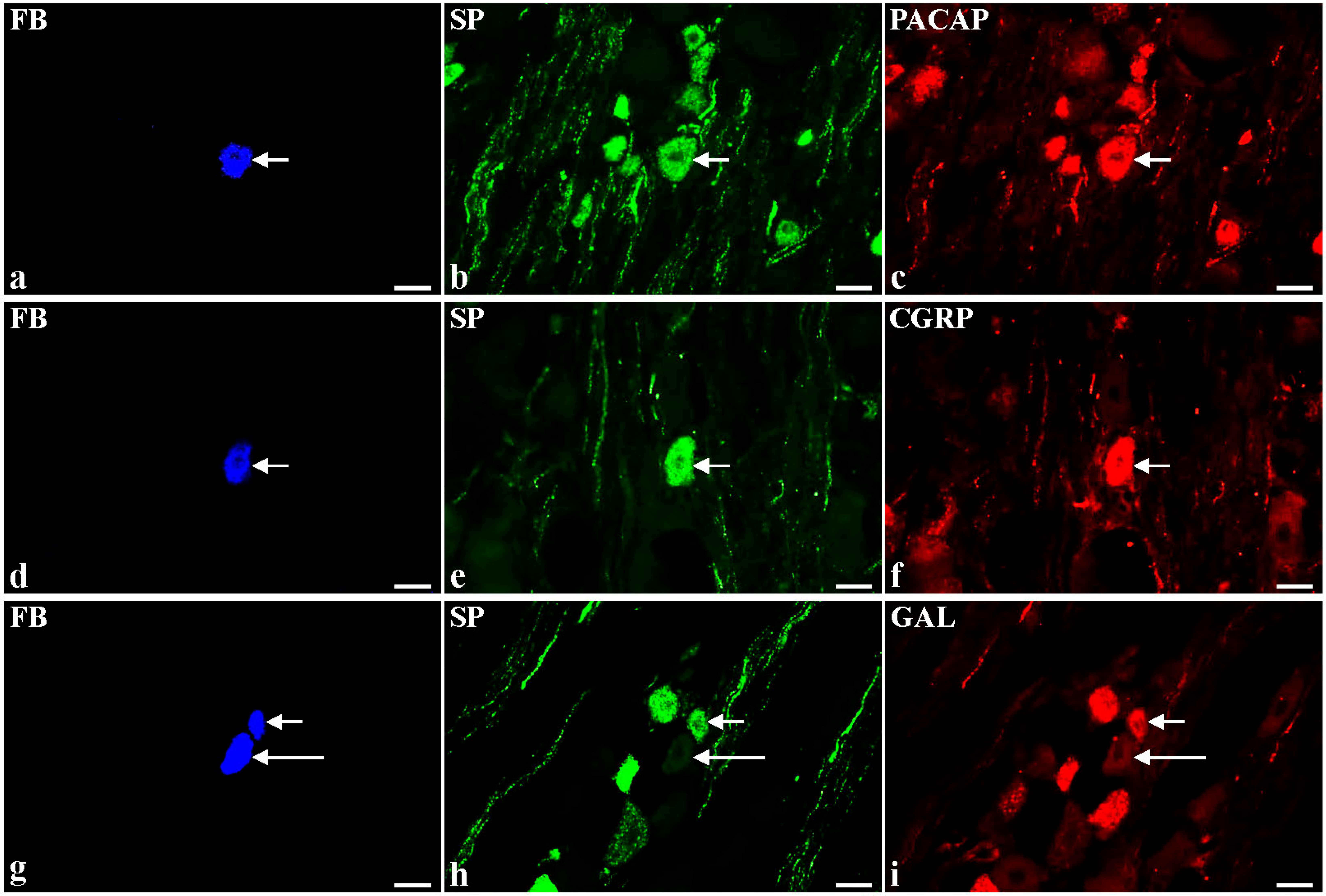 Toxins Free Full Text Botulinum Toxin Type A Induces Changes In The Chemical Coding Of Substance P Immunoreactive Dorsal Root Ganglia Sensory Neurons Supplying The Porcine Urinary Bladder Html