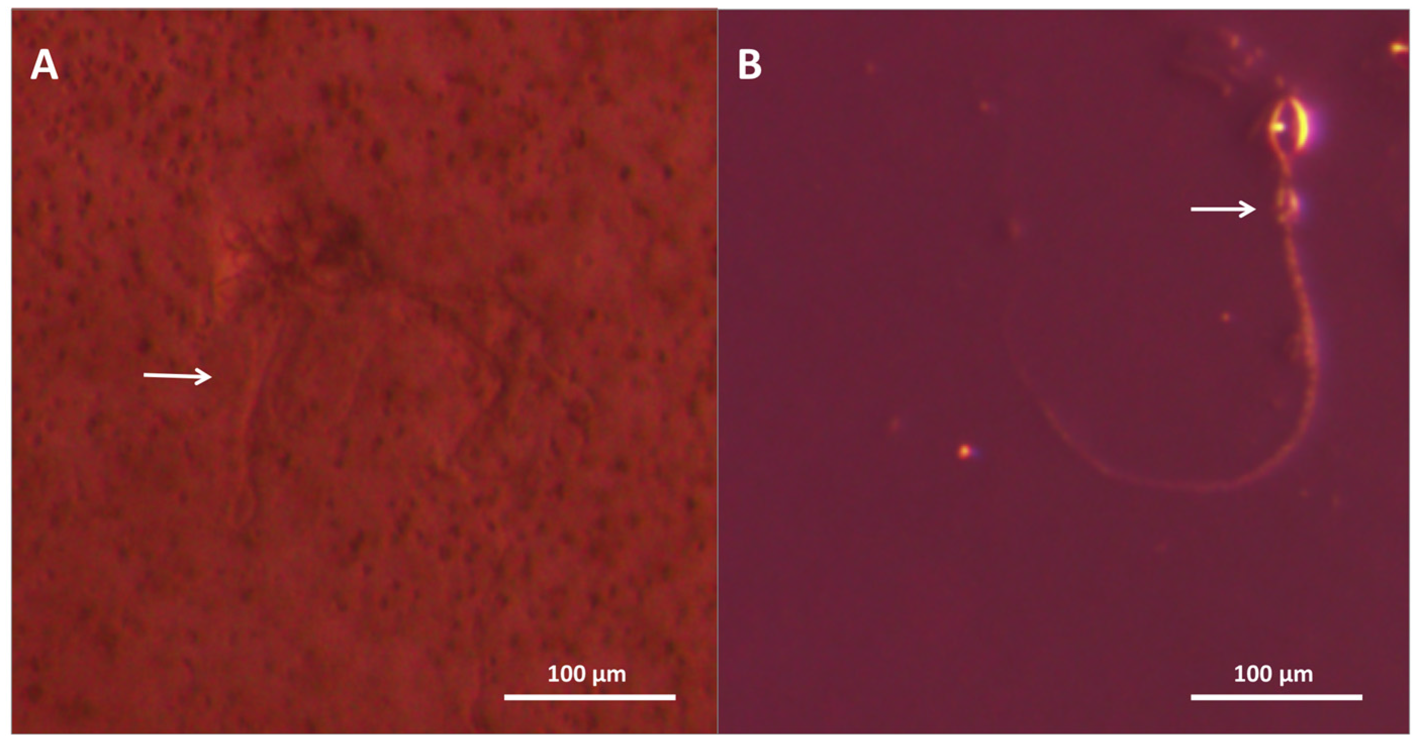 Toxins 08 00019 g009 1024