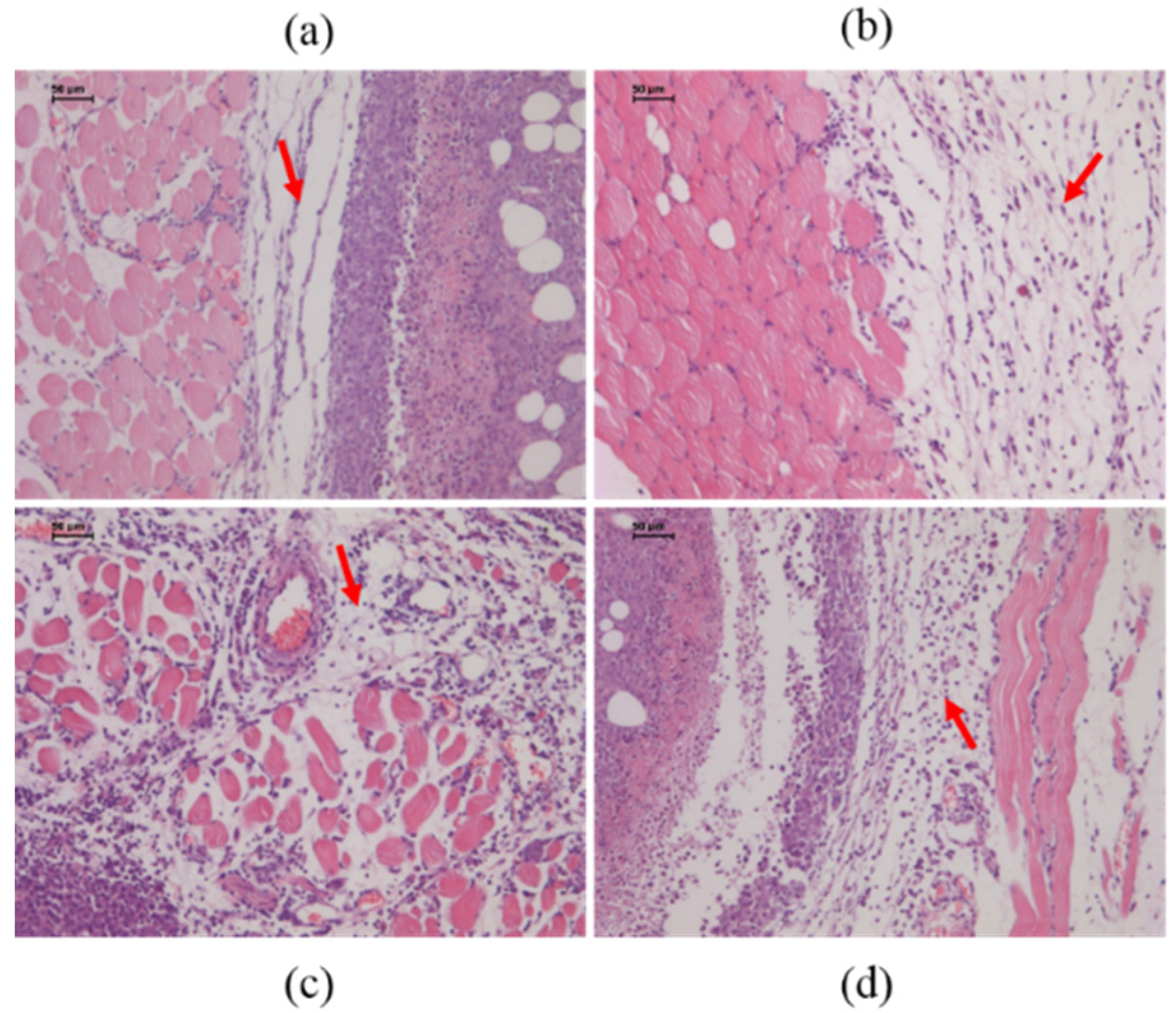 Toxins 08 00185 g004