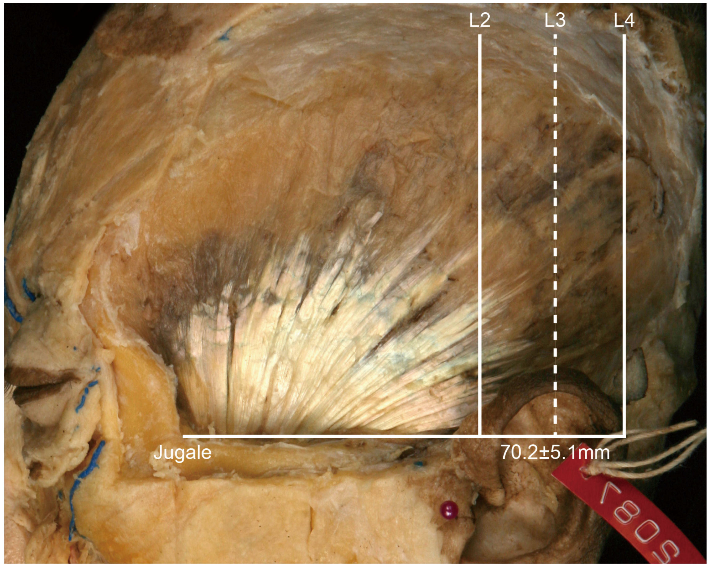 Toxins 08 00265 g003