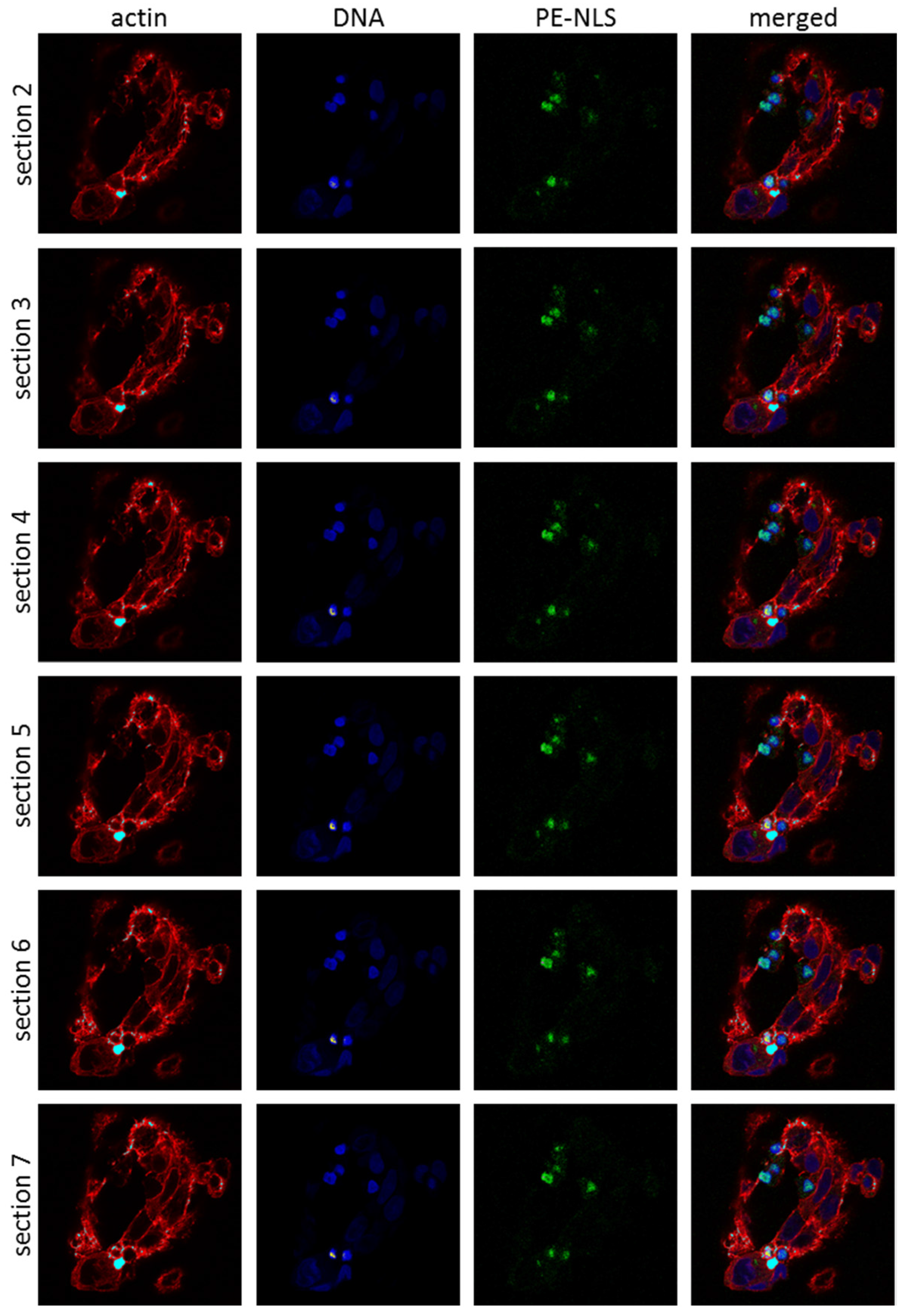 Toxins 08 00321 g004