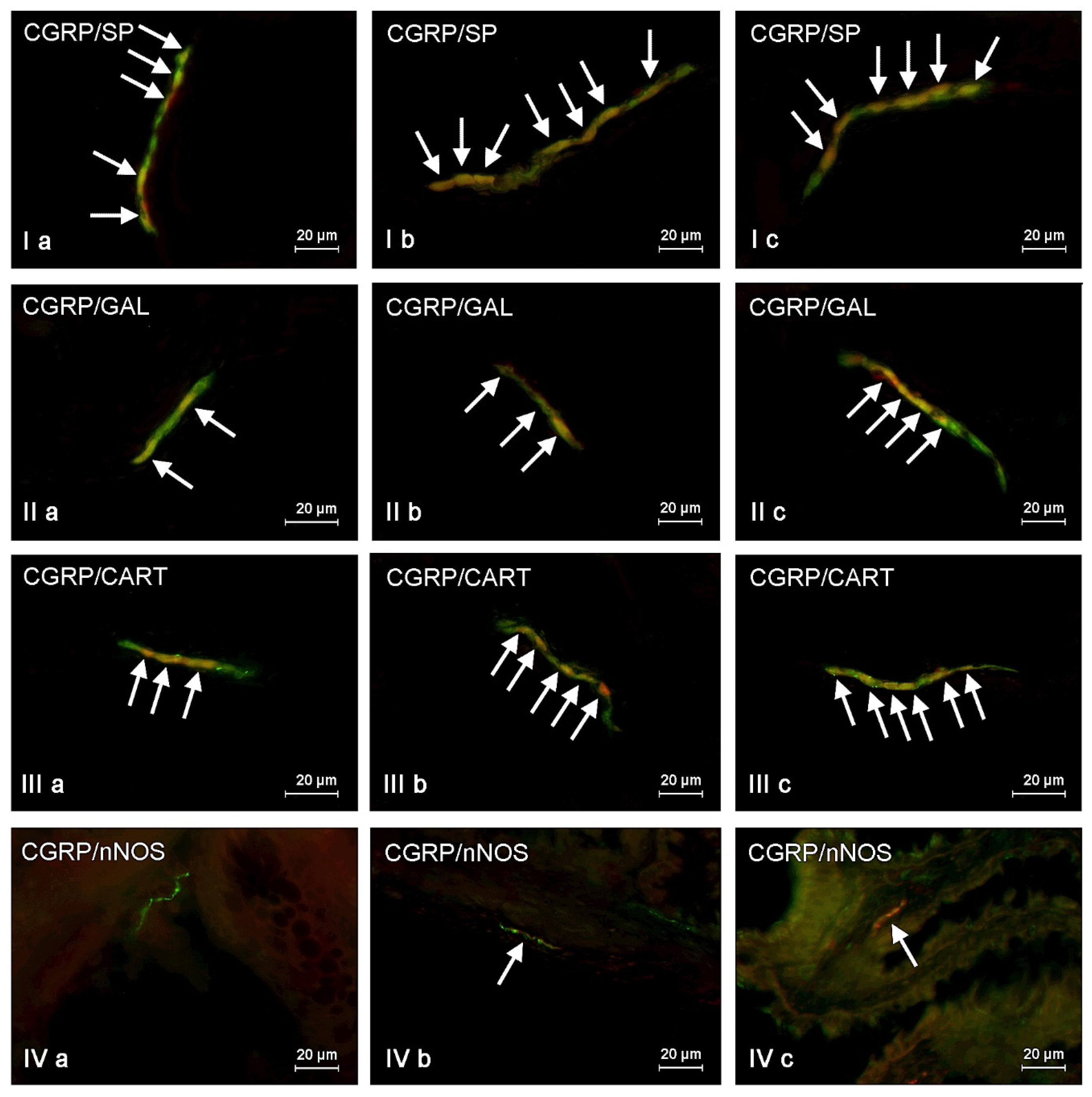 Toxins 09 00098 g004