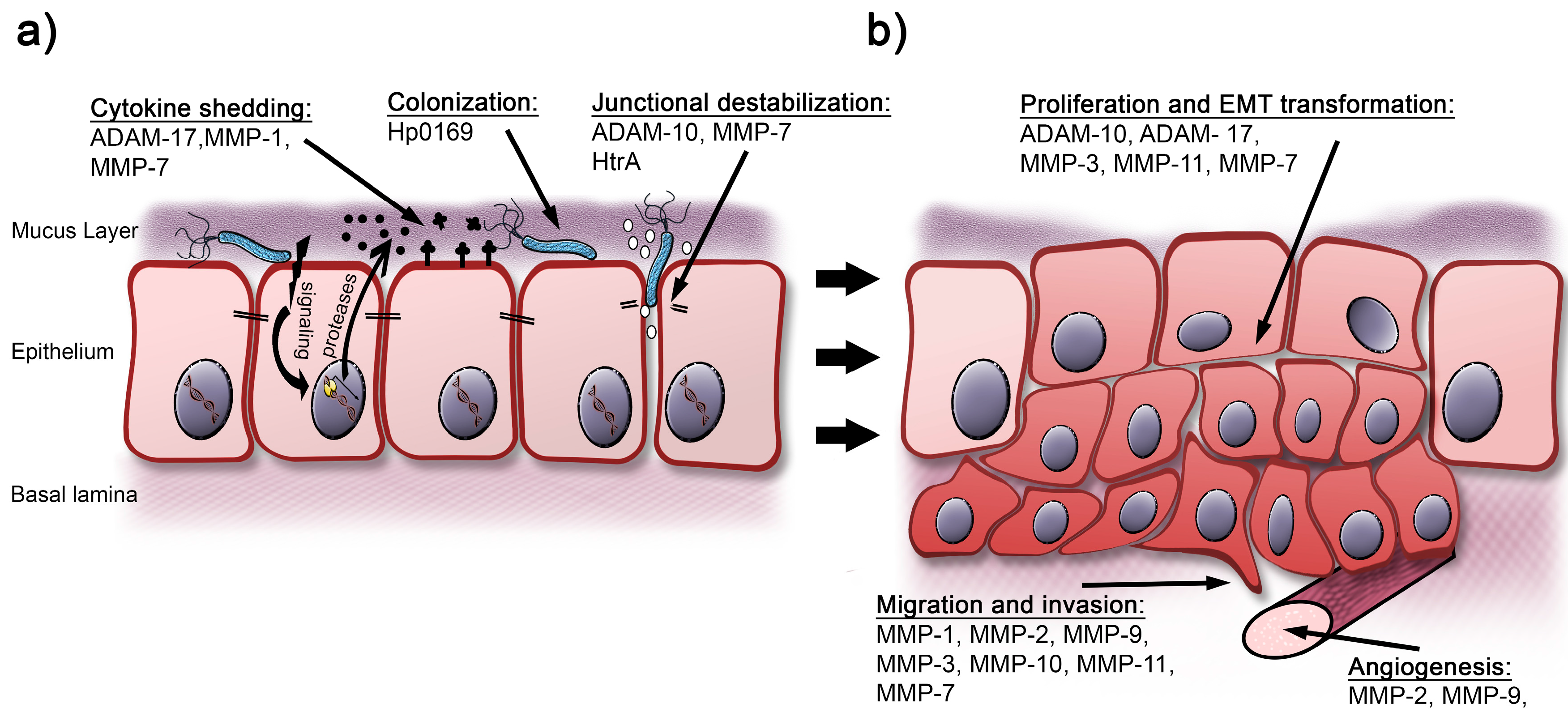 gastric cancer h pylori