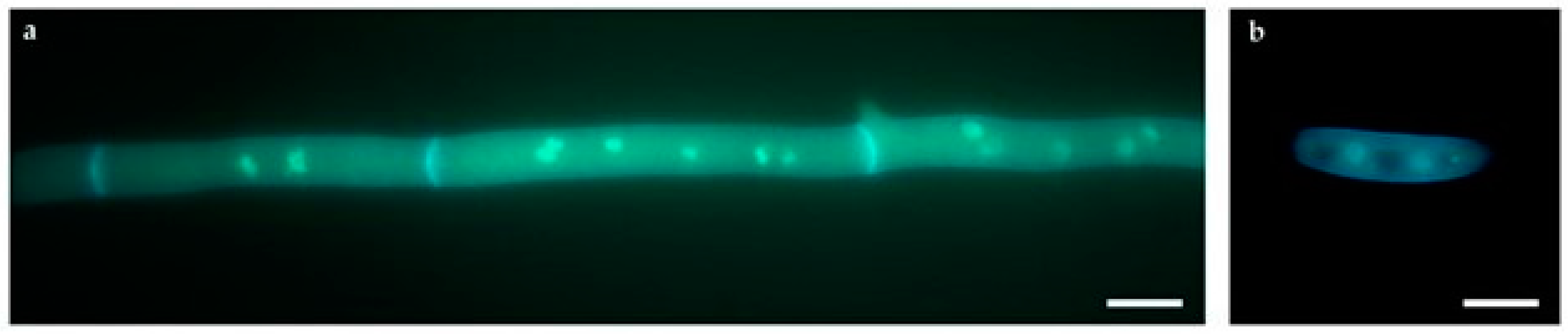 Toxins 09 00183 g006 550