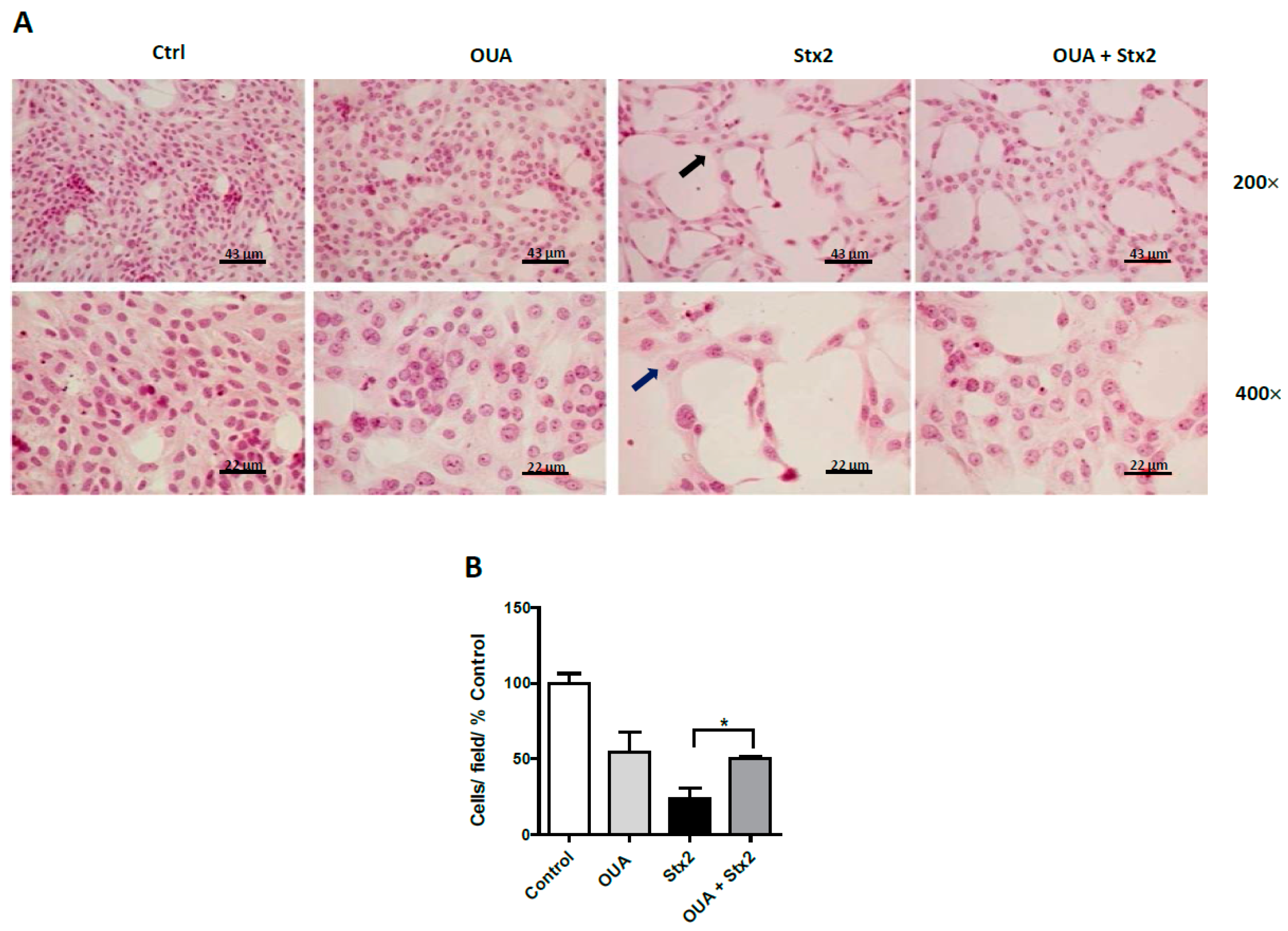 Toxins 09 00226 g004