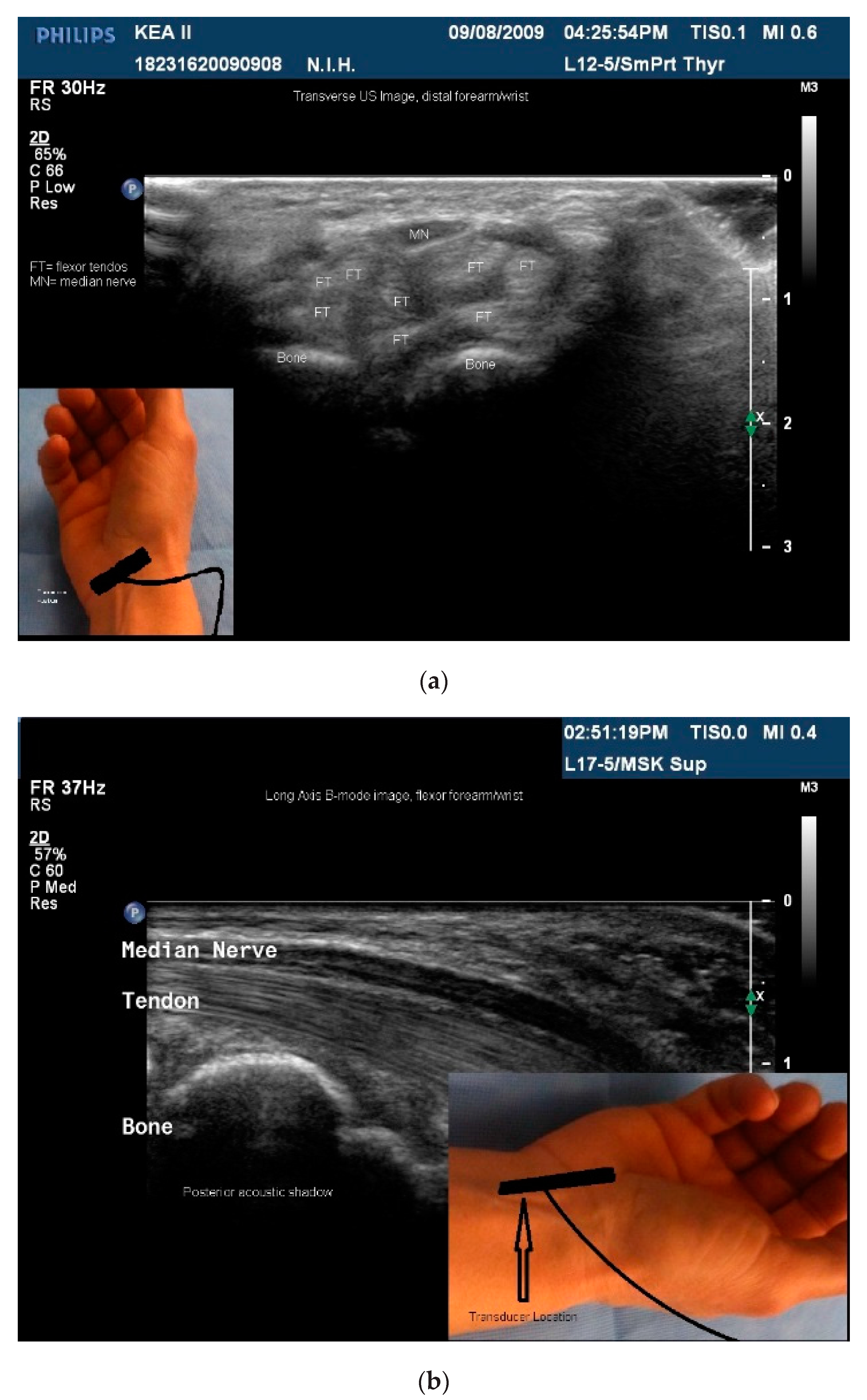 Toxins 10 00018 g002