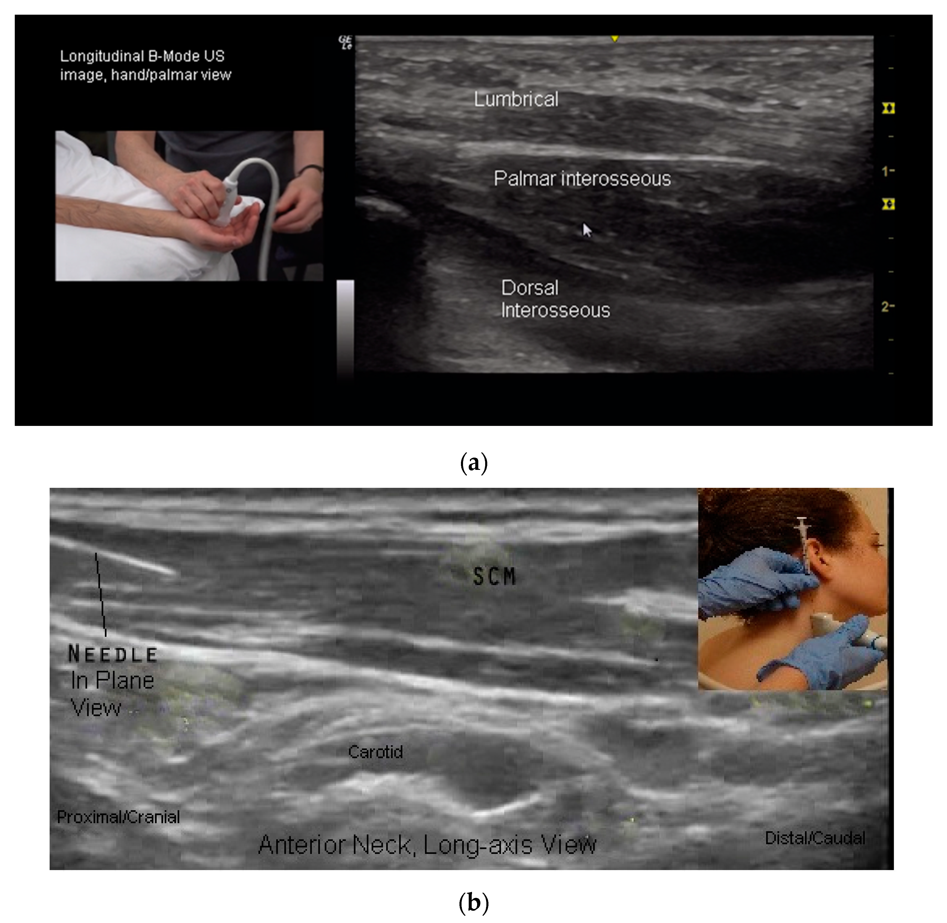 Toxins 10 00018 g006a