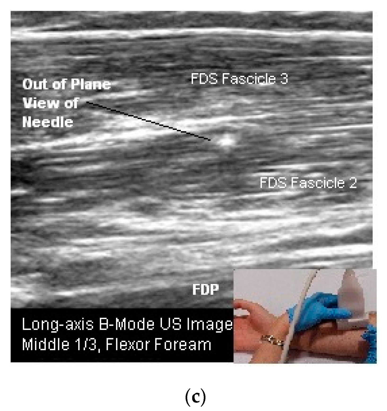 Toxins 10 00018 g006b