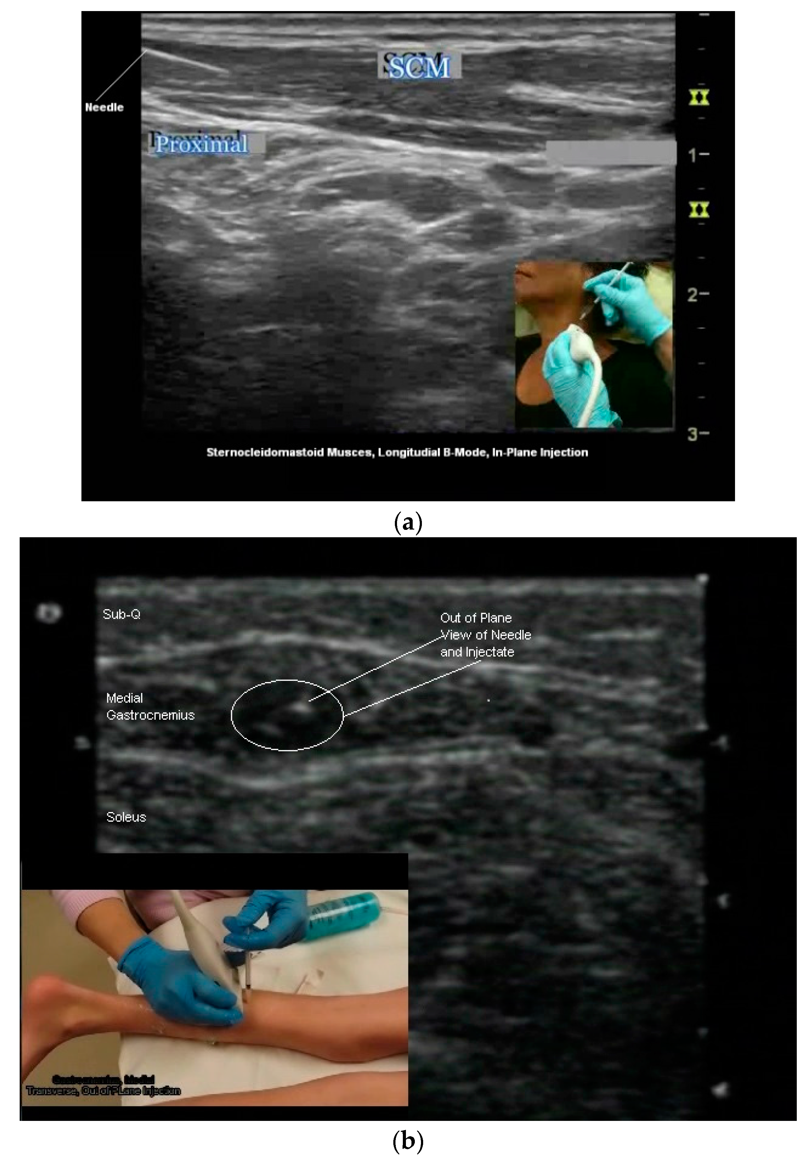 Toxins 10 00018 g007a