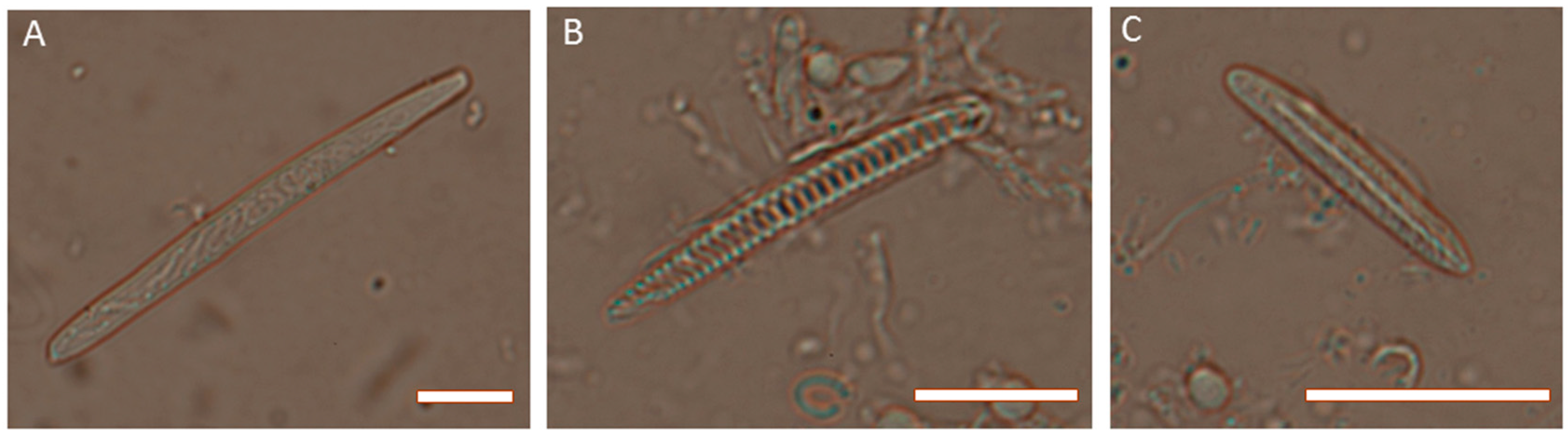 Toxins 10 00036 g003