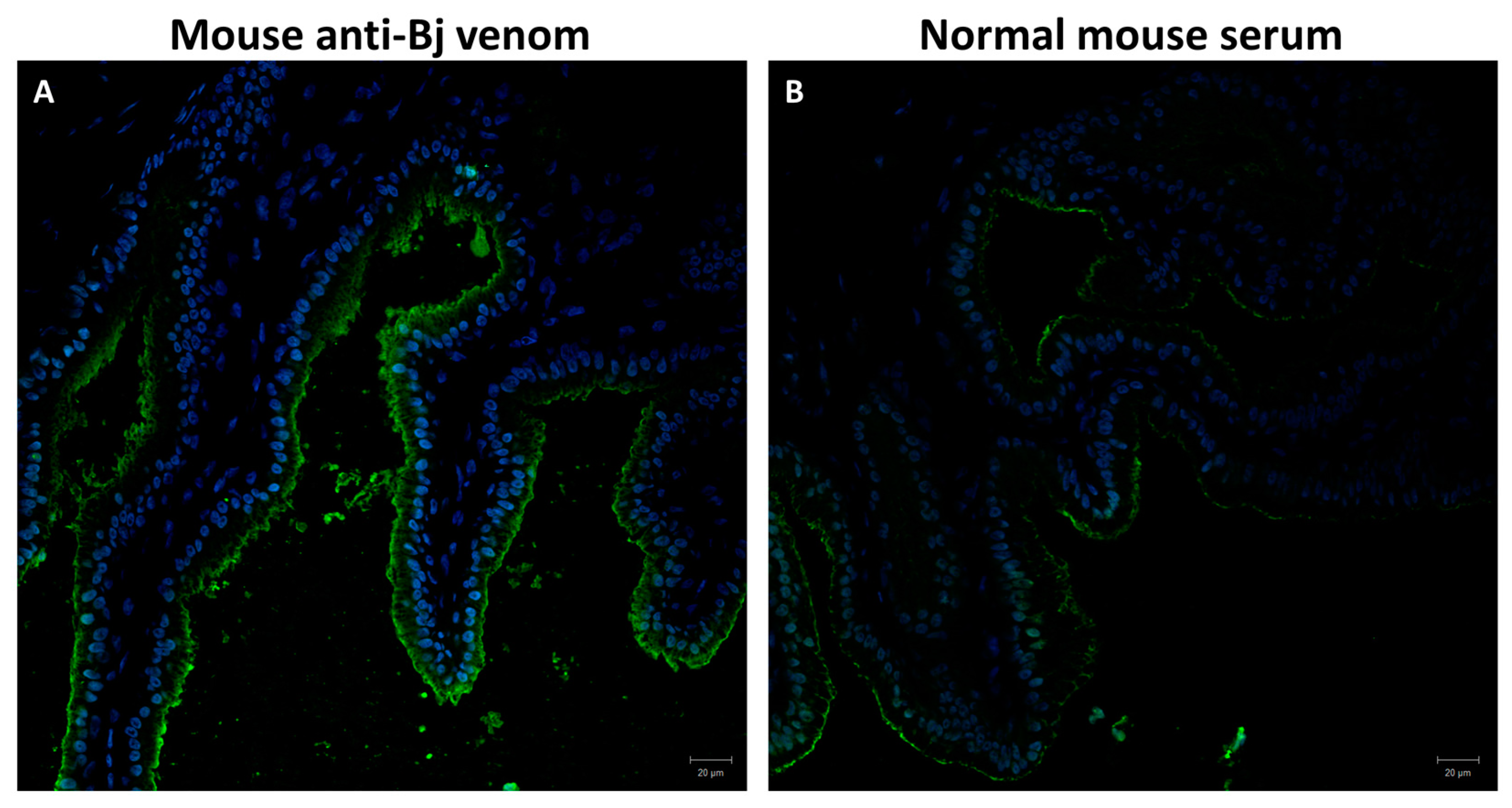 Toxins 10 00121 g005