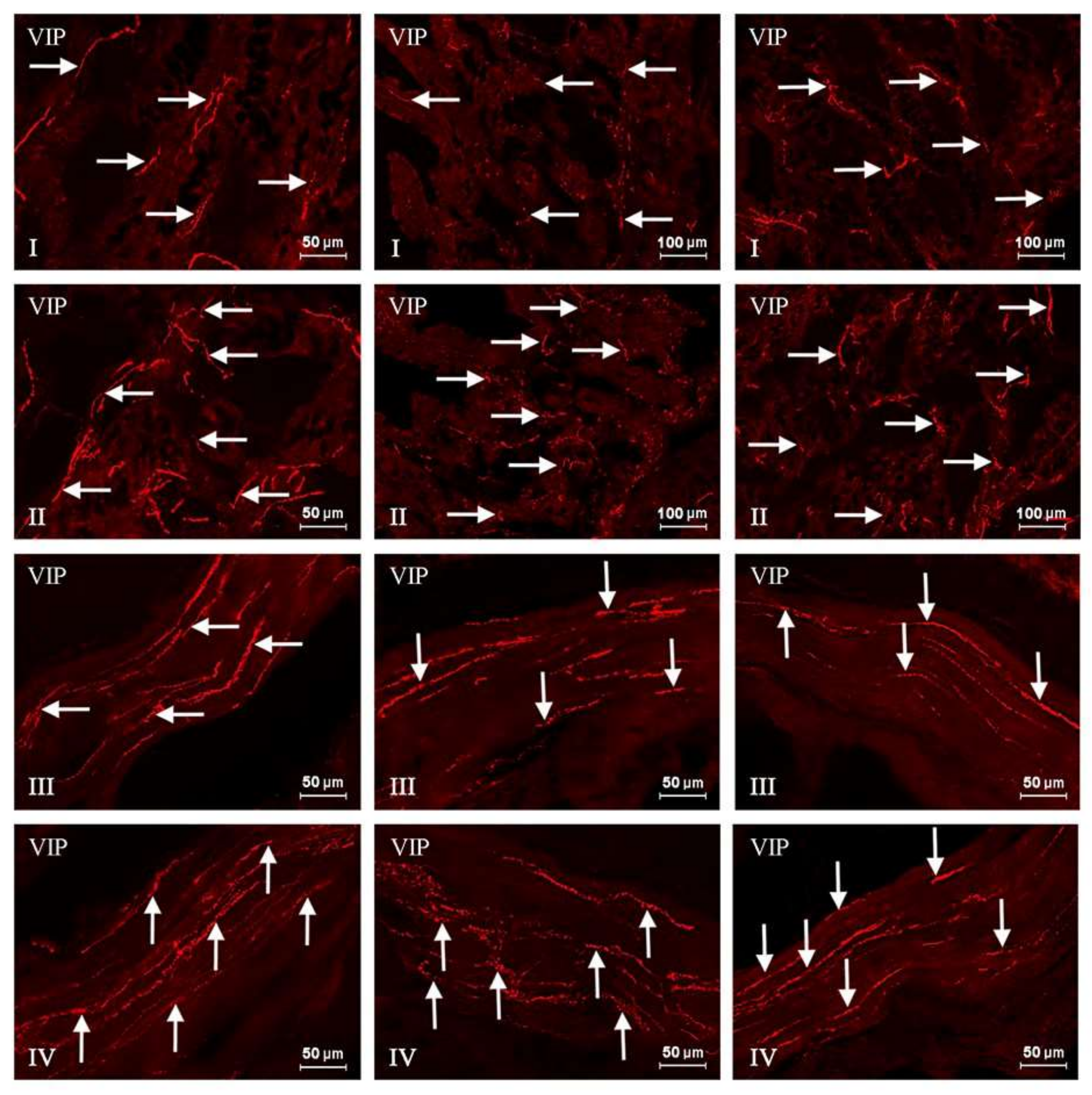 Toxins 10 00138 g004