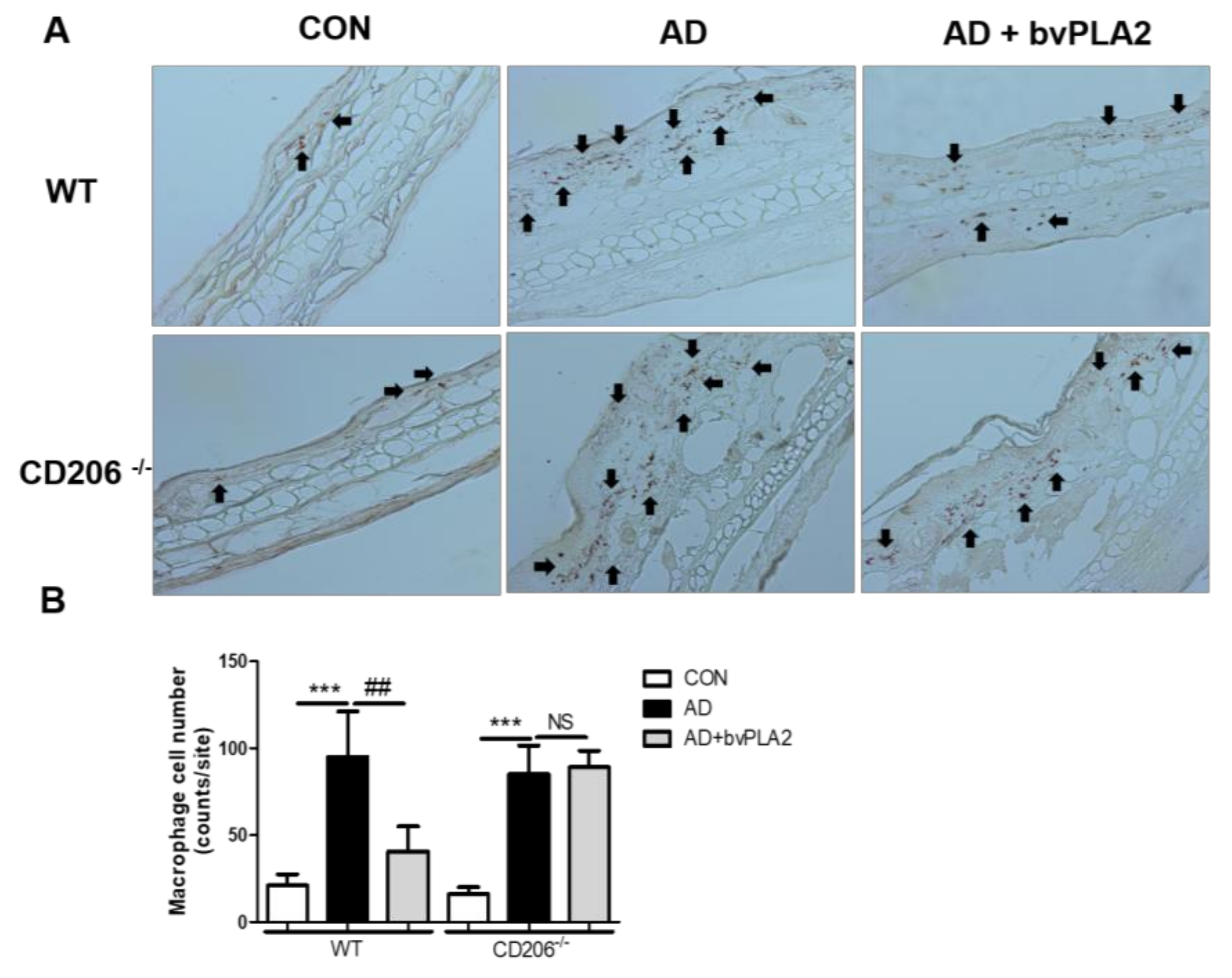 Toxins 10 00146 g004
