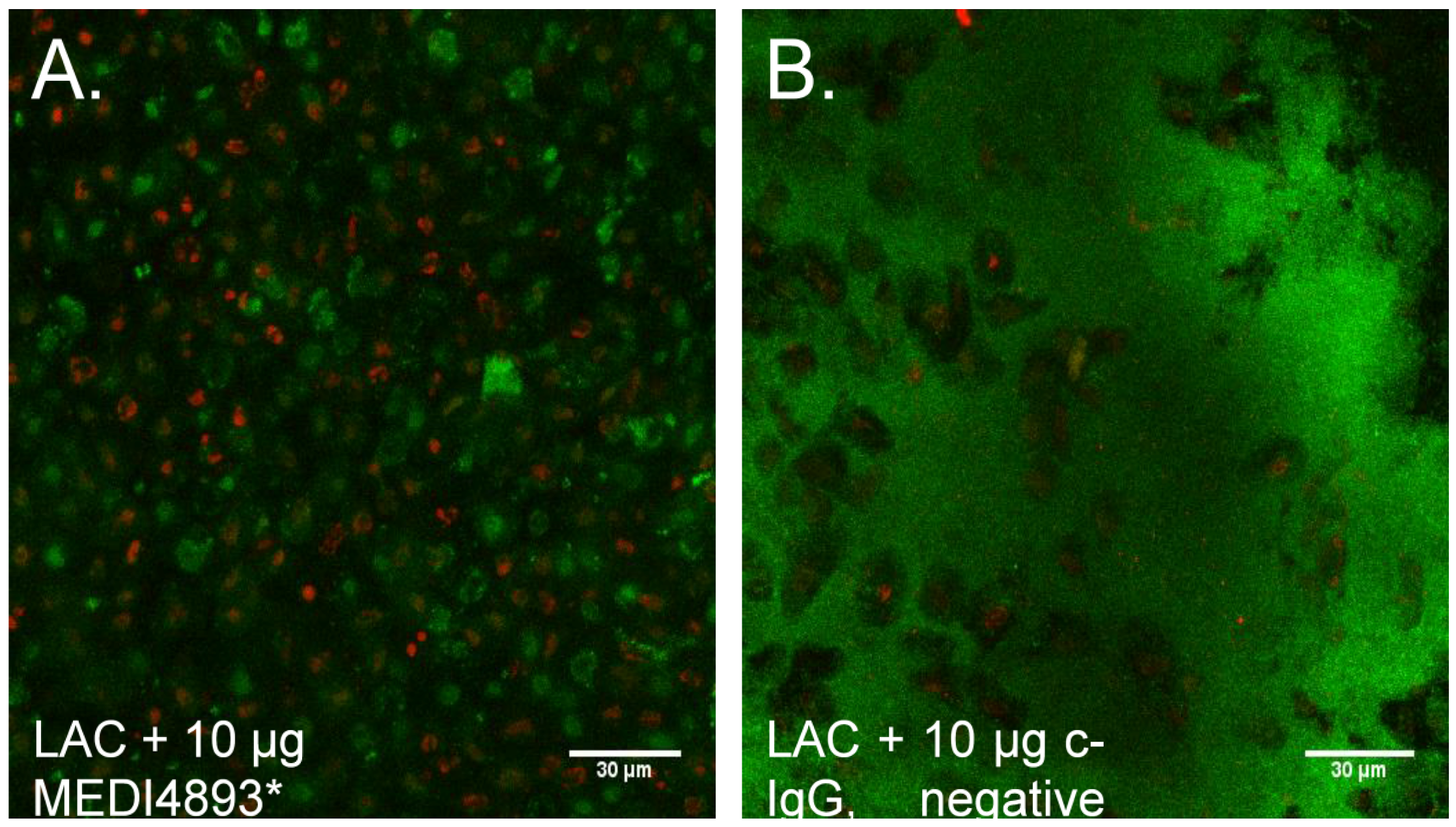 Toxins Free FullText AlphaToxin Contributes to Biofilm Formation