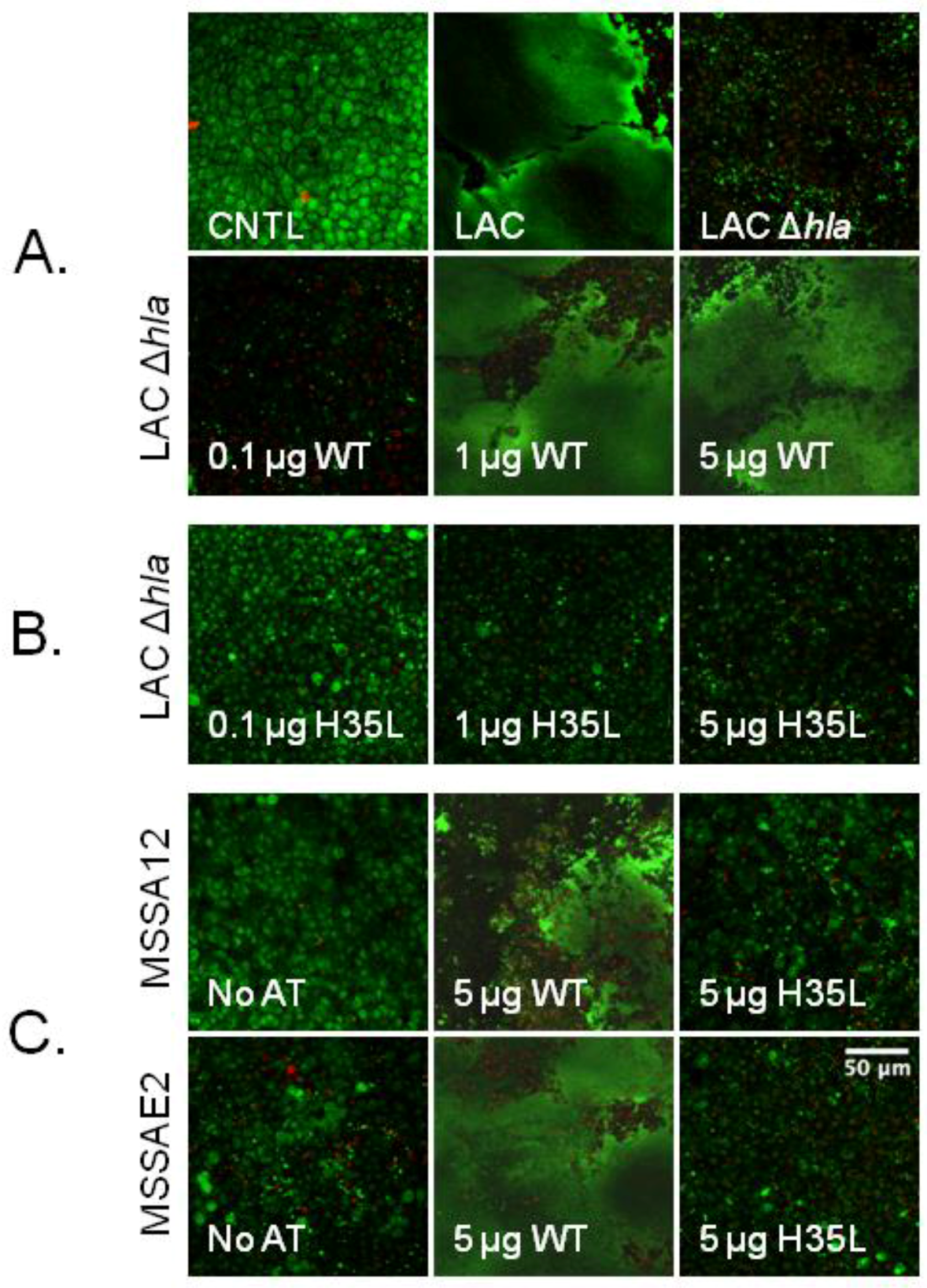 Toxins Free FullText AlphaToxin Contributes to Biofilm Formation