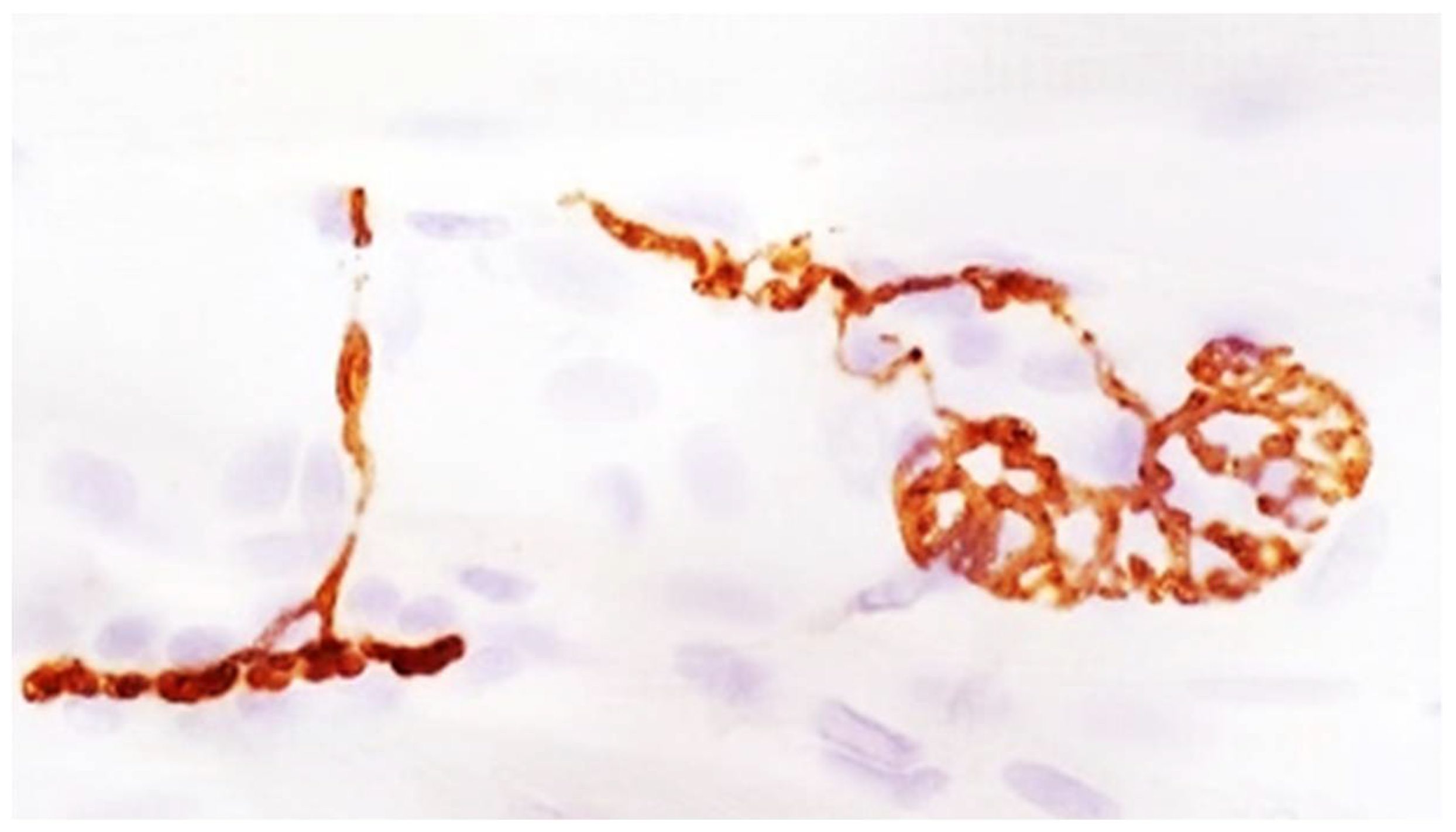 Toxins 10 00208 g003