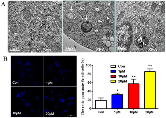 The Effects of Autophagy and PI3K/AKT/m-TOR Signaling