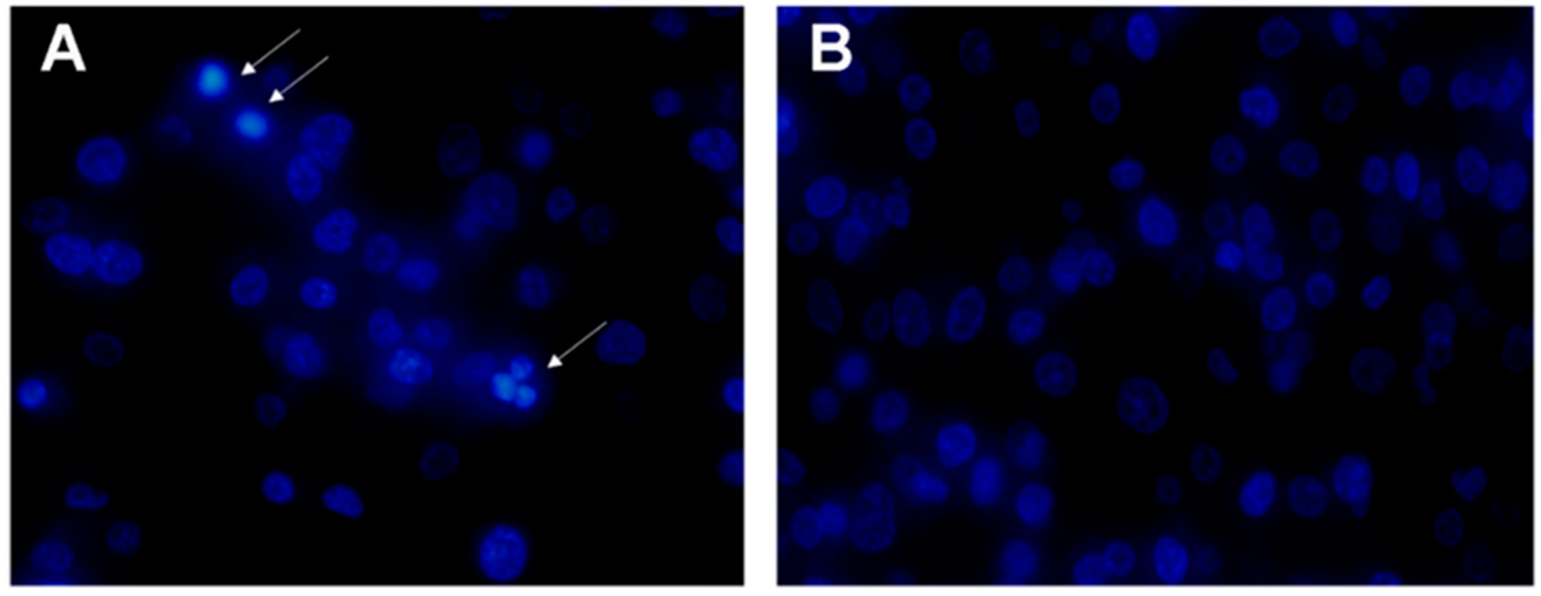 Toxins 10 00451 g006 Toxins 10 00451 g006