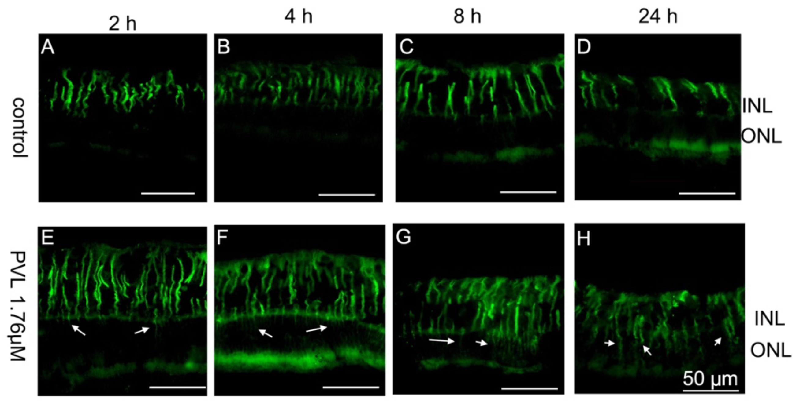Toxins 10 00455 g003 Toxins 10 00455 g003