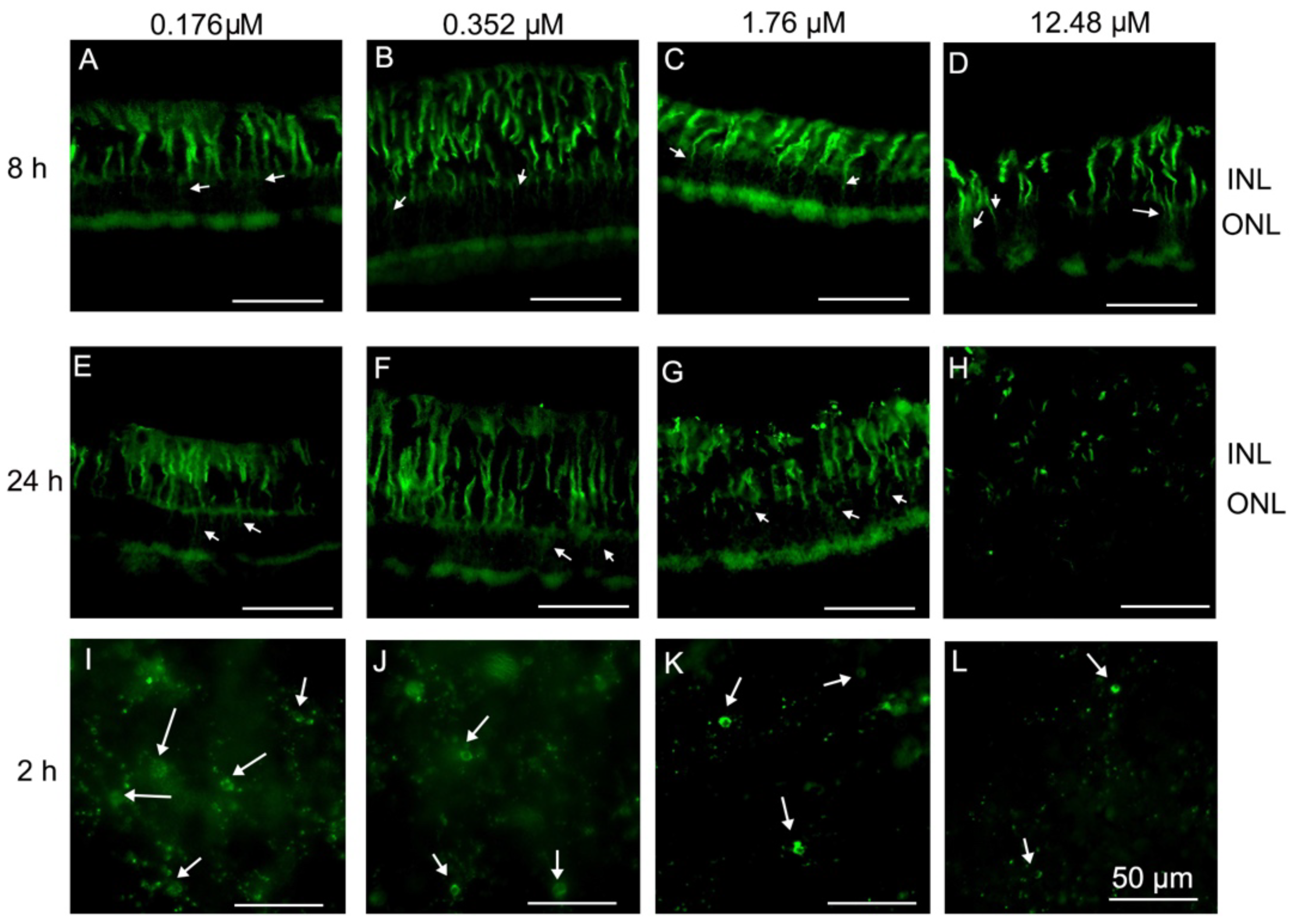 Toxins 10 00455 g004 Toxins 10 00455 g004