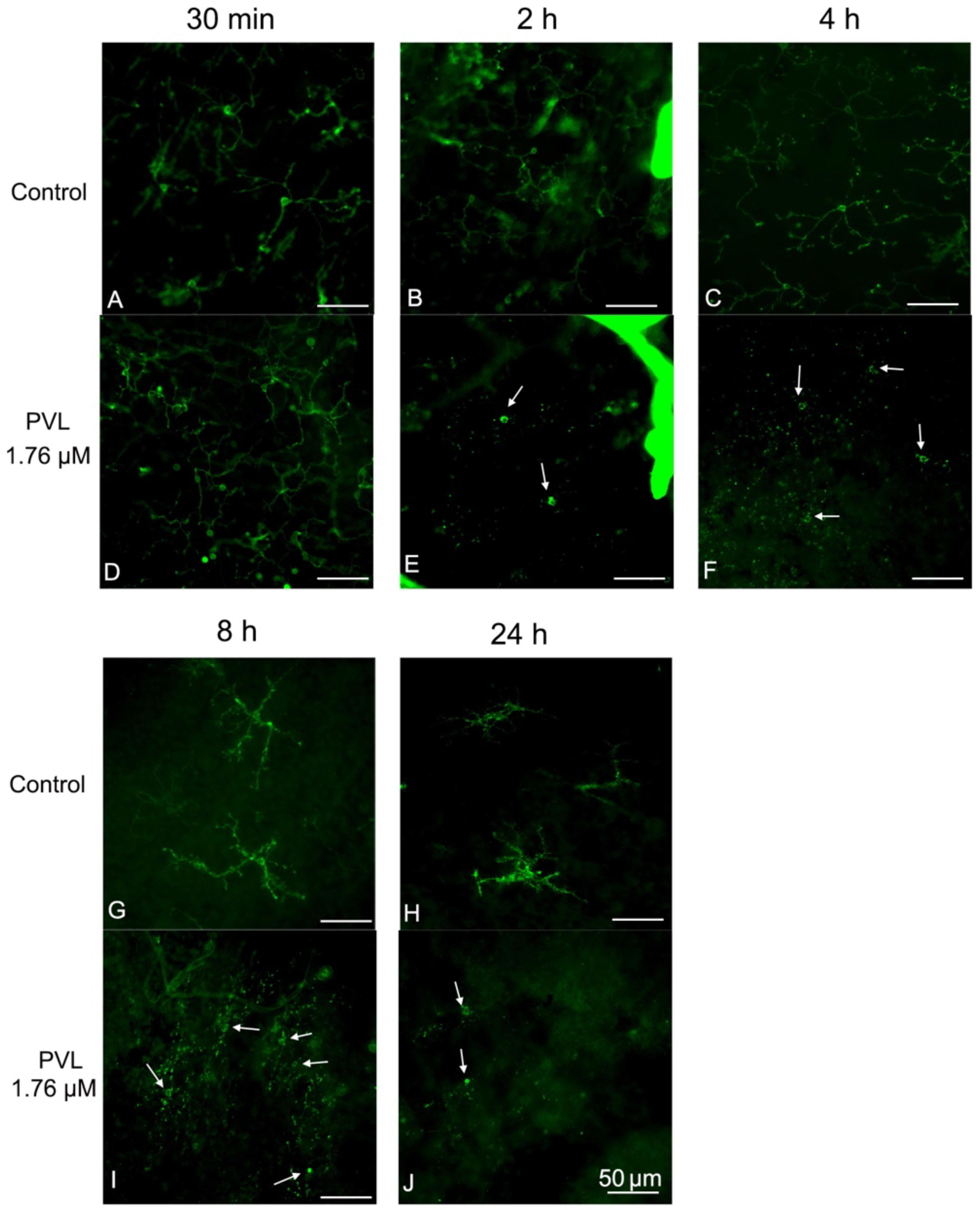 Toxins 10 00455 g005 Toxins 10 00455 g005