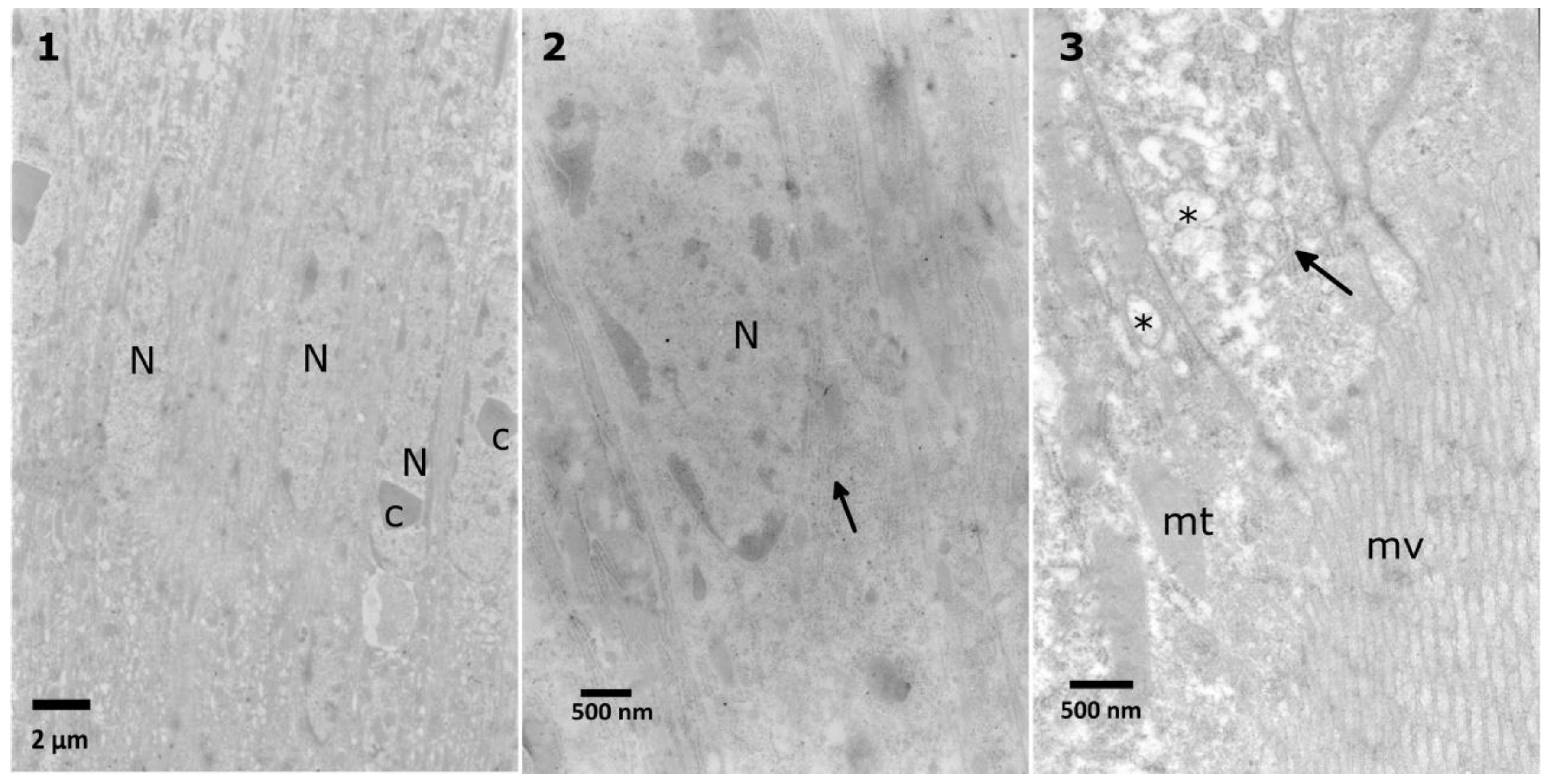 Toxins 10 00504 g005