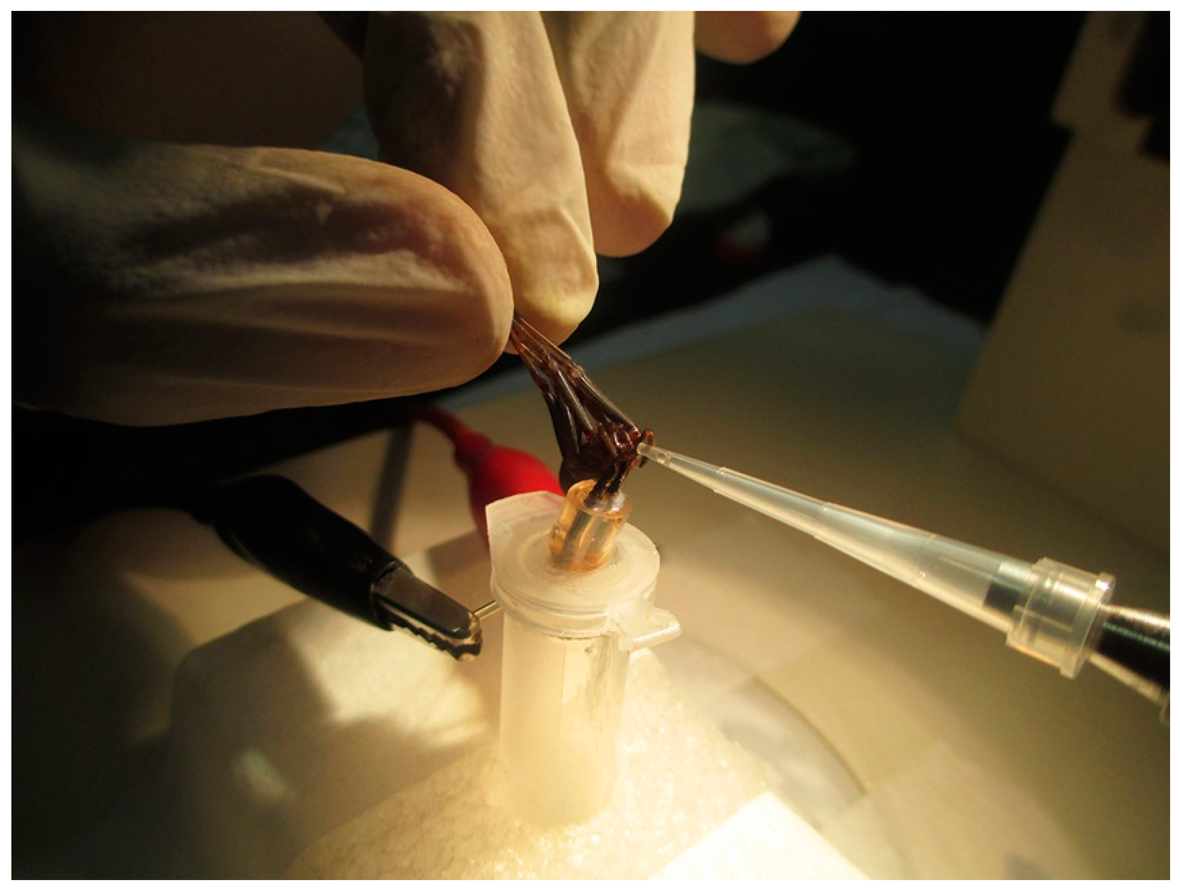 Toxins 10 00522 g010 Toxins 10 00522 g010