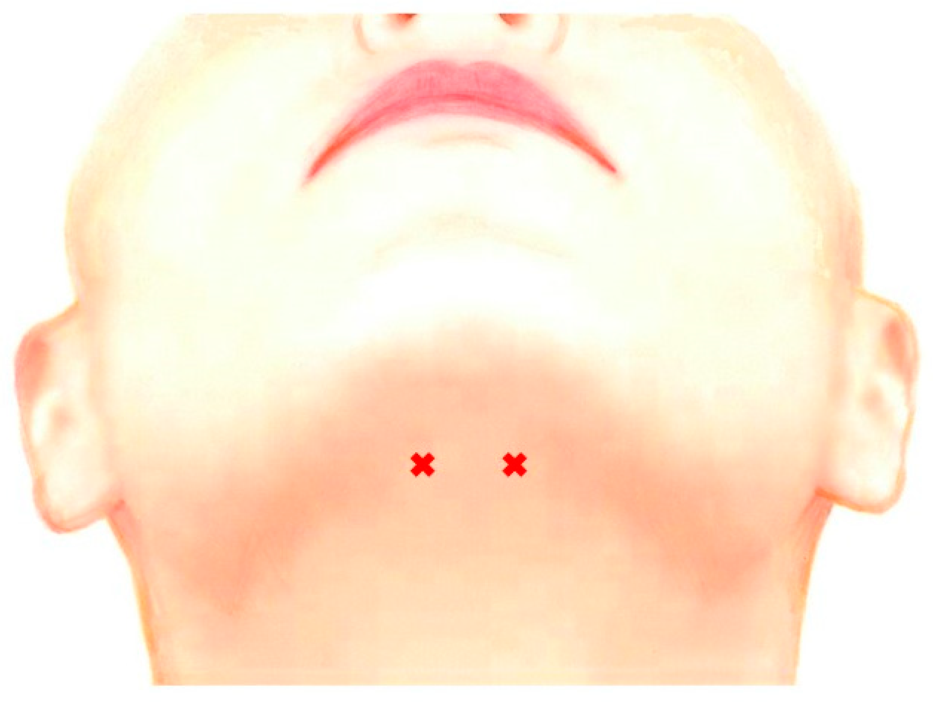 Toxins 11 00051 g005 Toxins 11 00051 g005