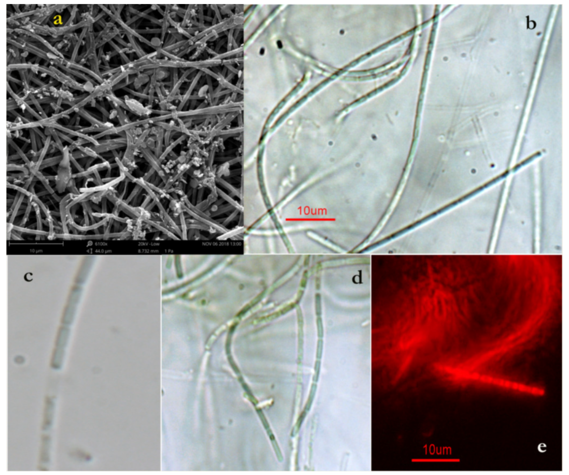 Toxins 11 00099 g001