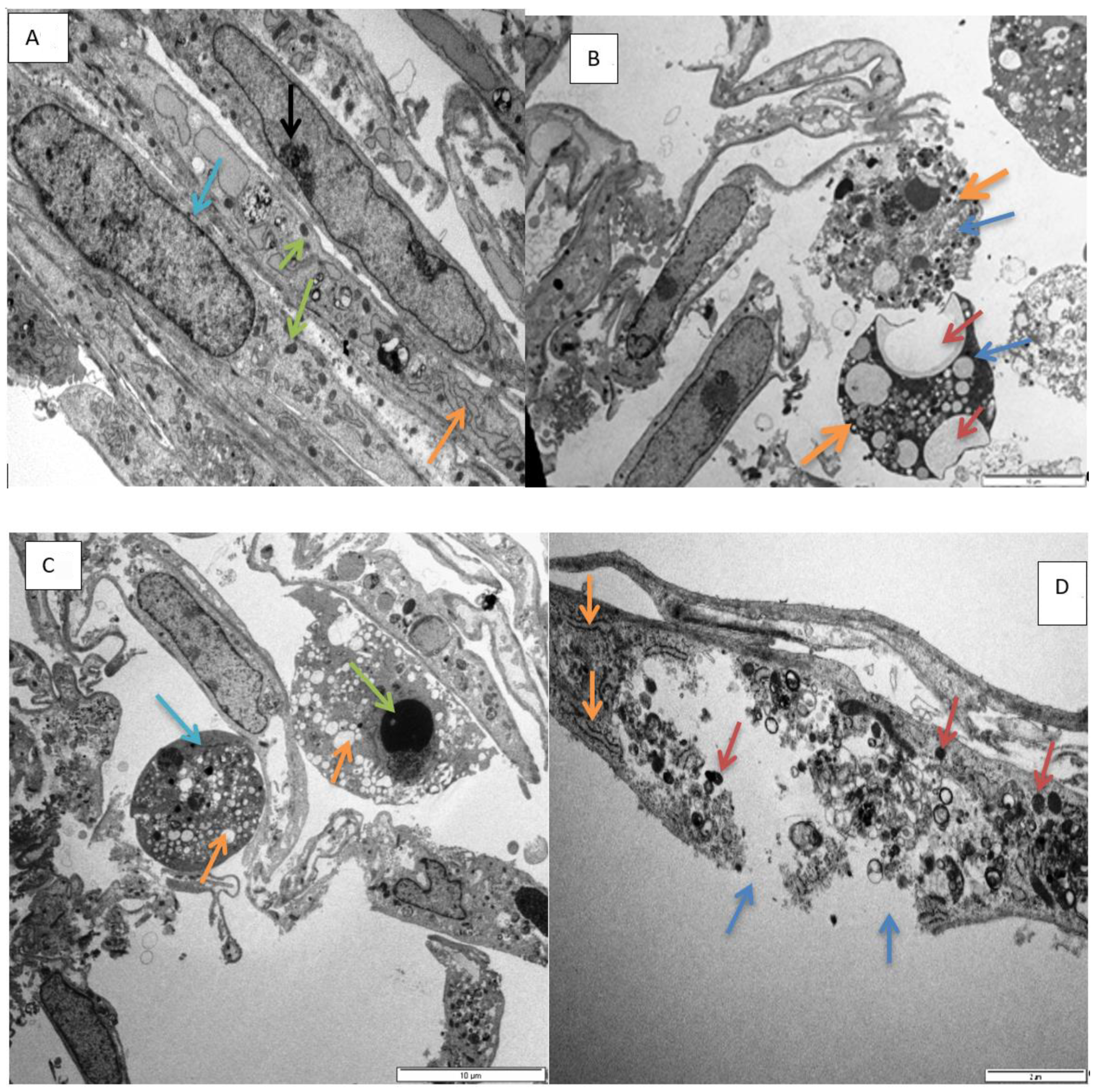 Toxins 11 00284 g005a