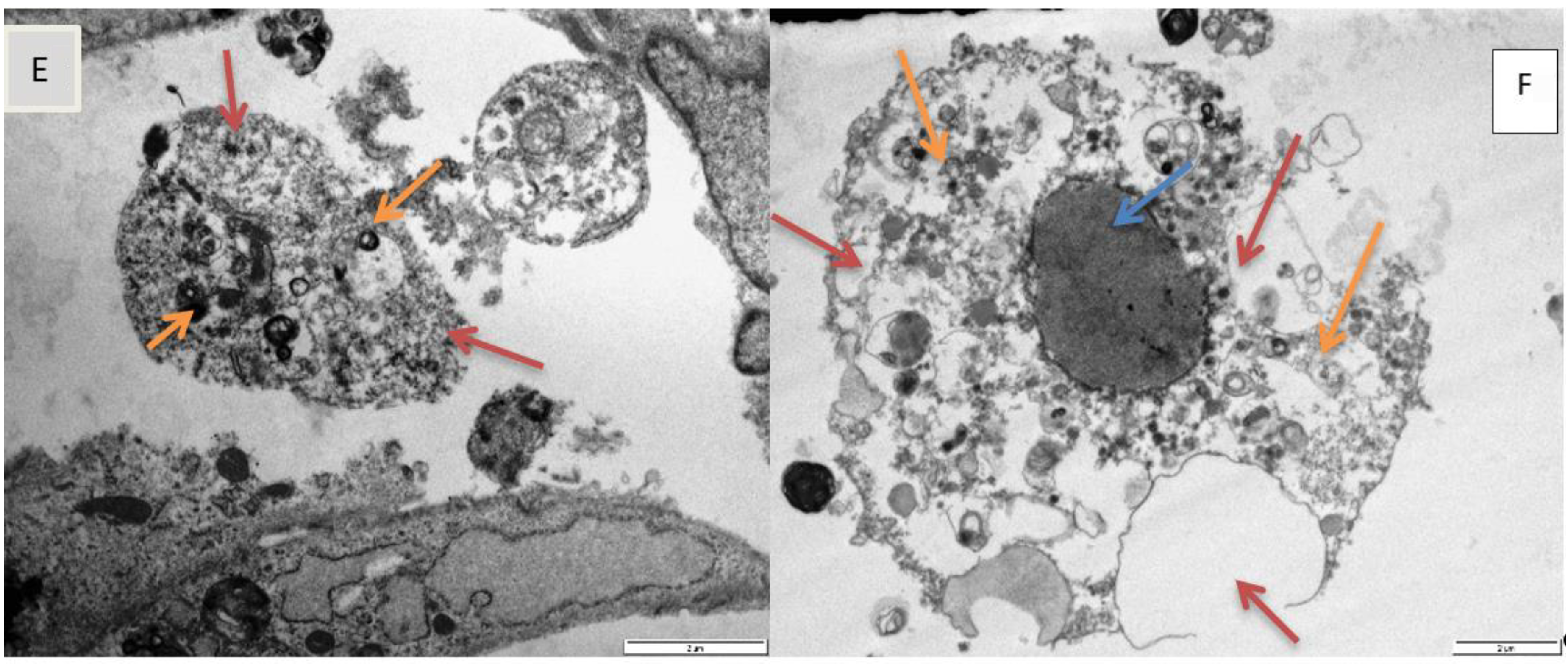 Toxins 11 00284 g005b