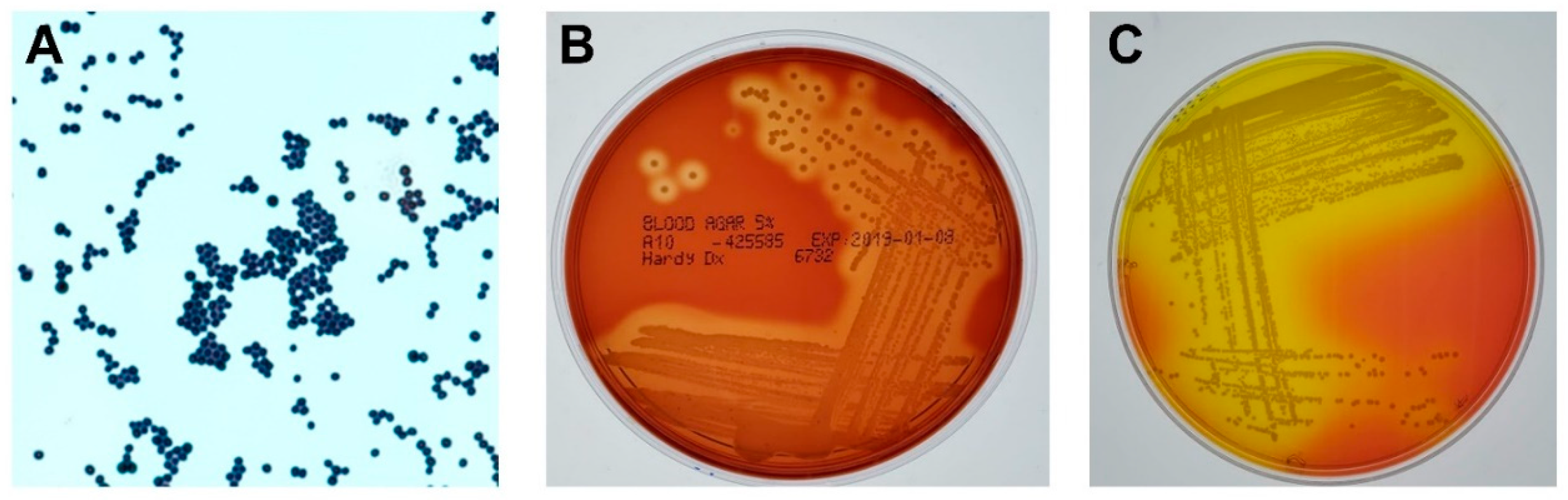 staphylococcus epidermidis gram stain