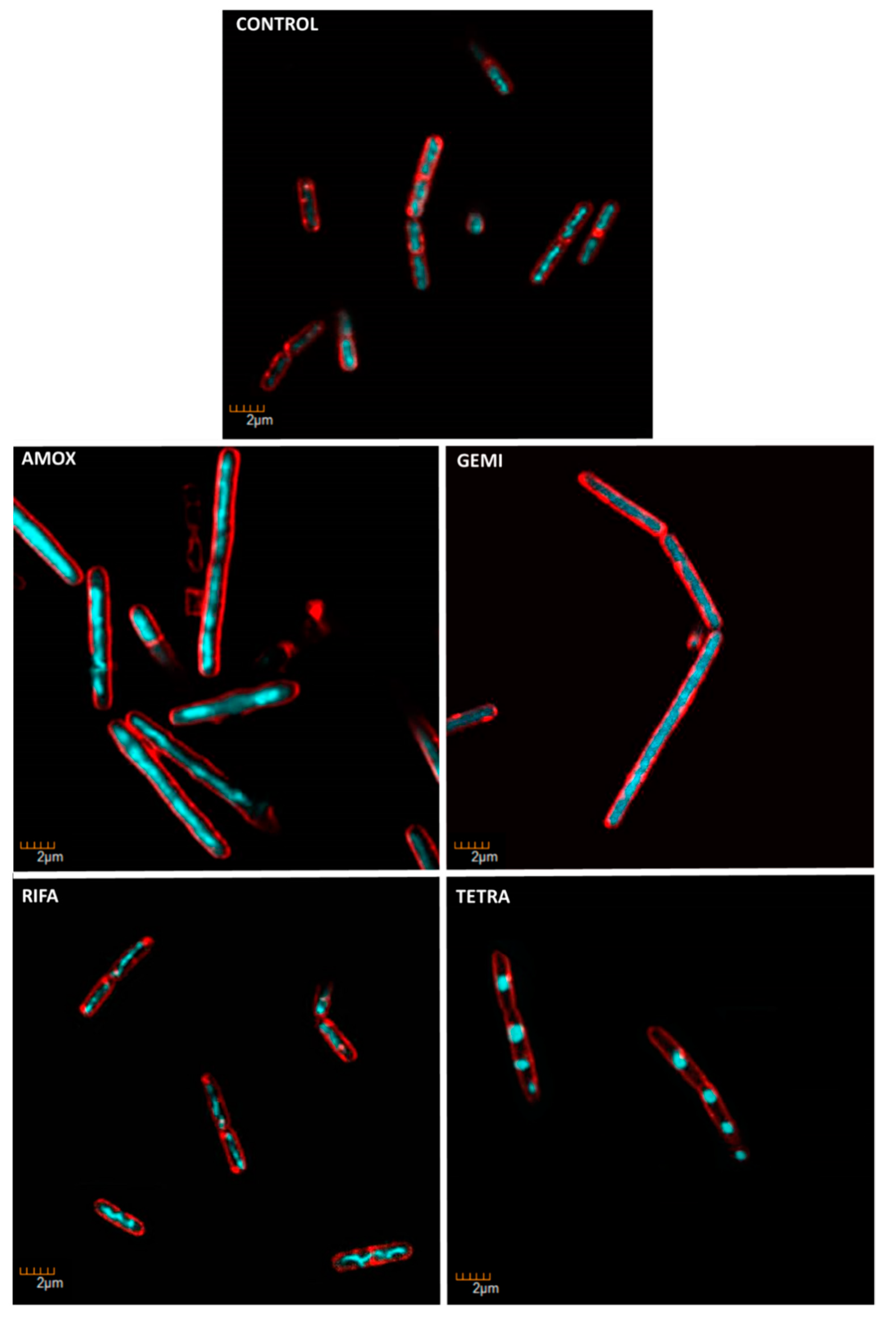 Toxins 11 00514 g011