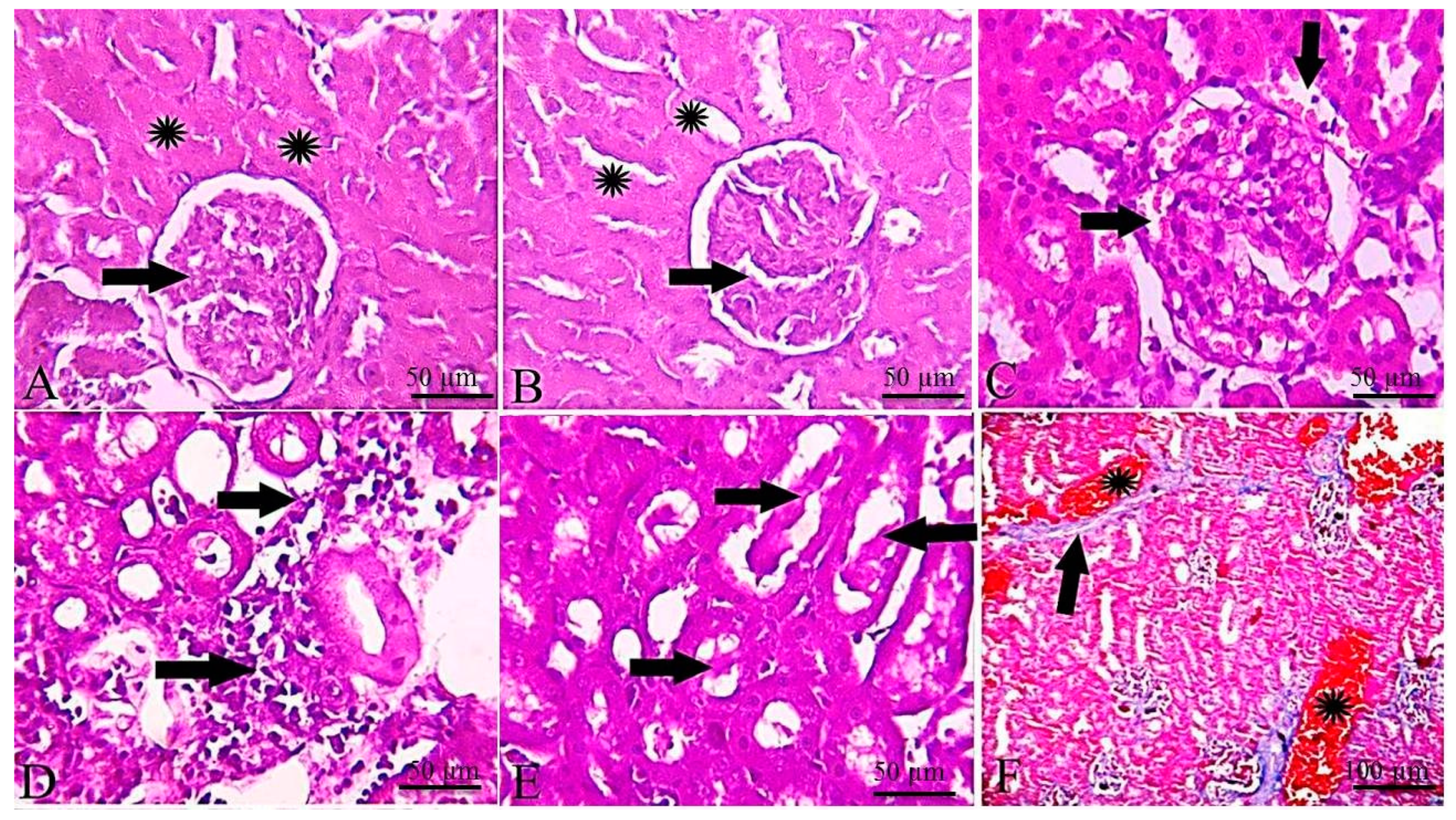 Toxins 11 00642 g003