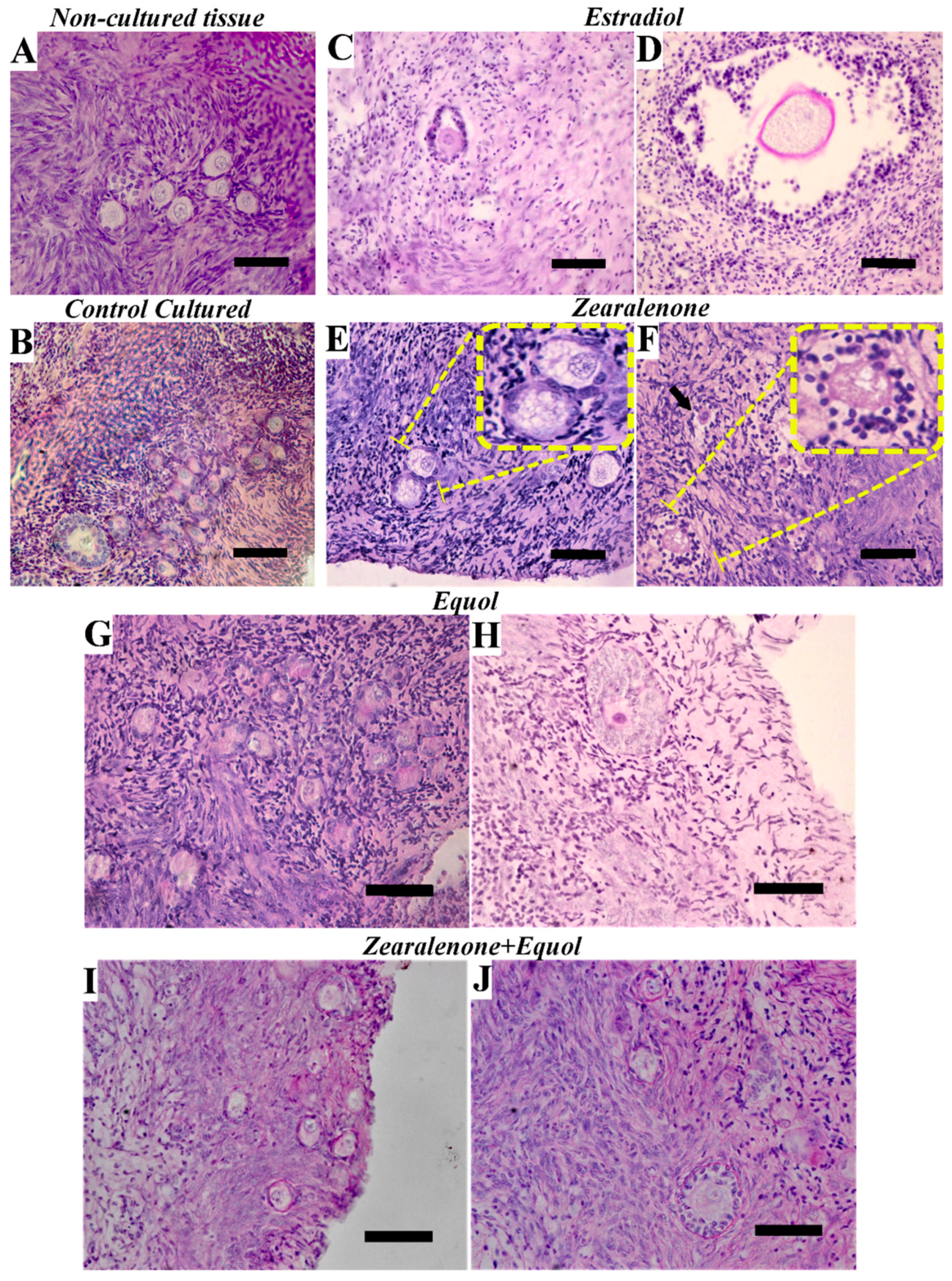 Toxins 11 00652 g001