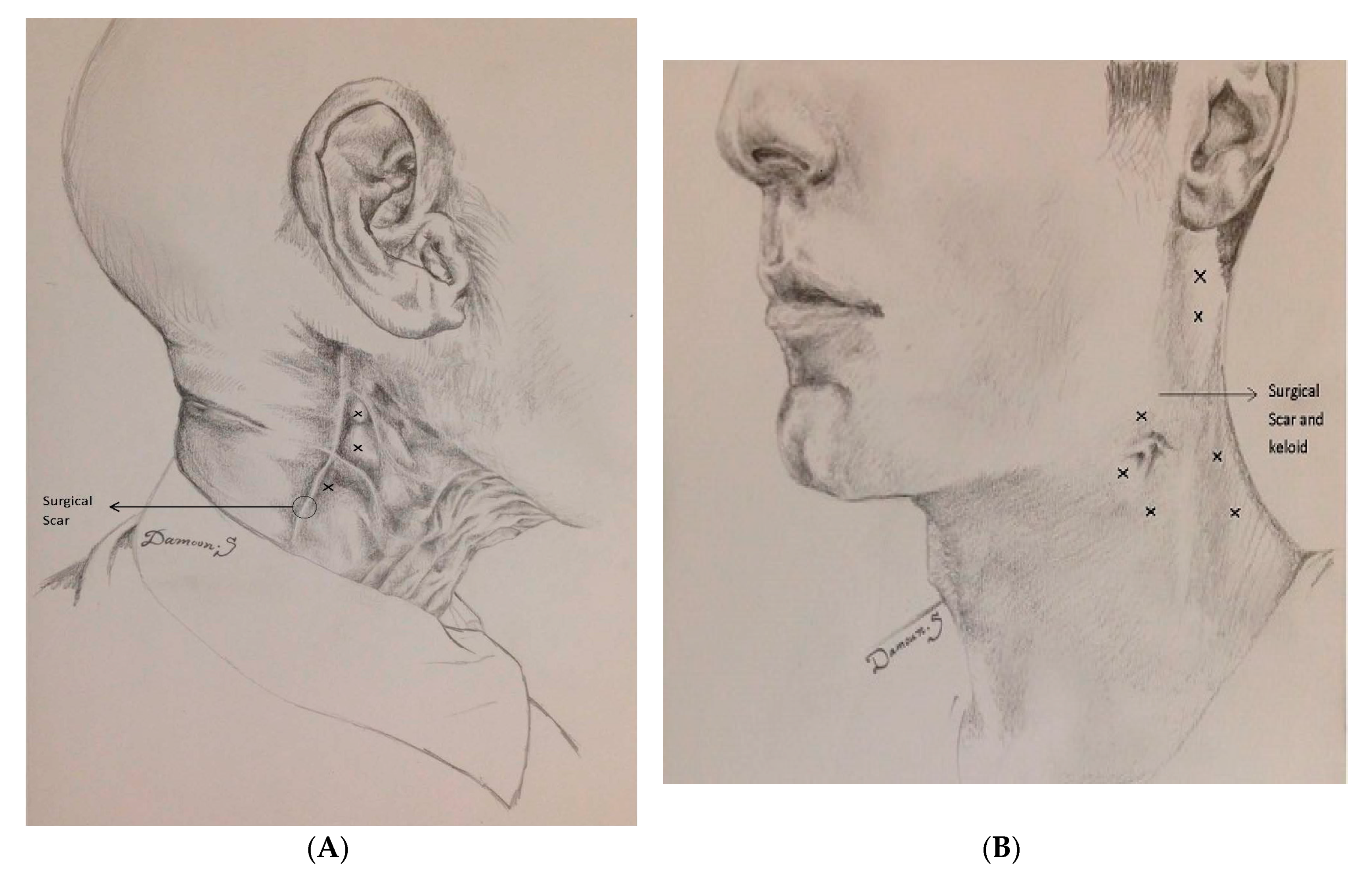 Toxins 12 00032 g002