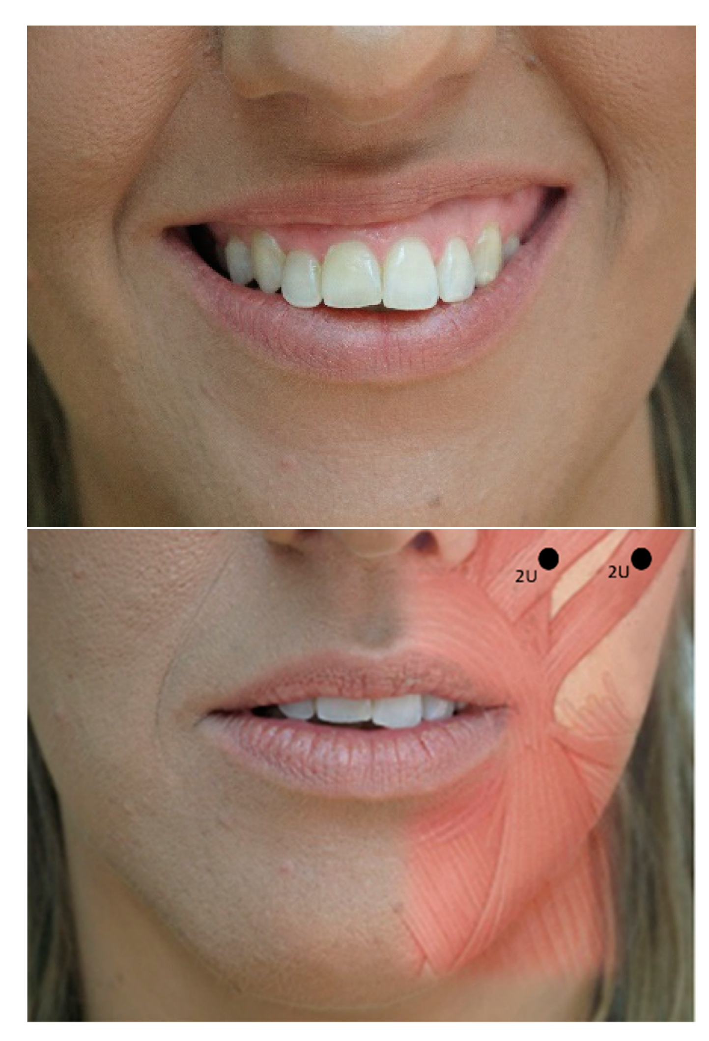 Toxins 12 00112 g003 Toxins 12 00112 g003