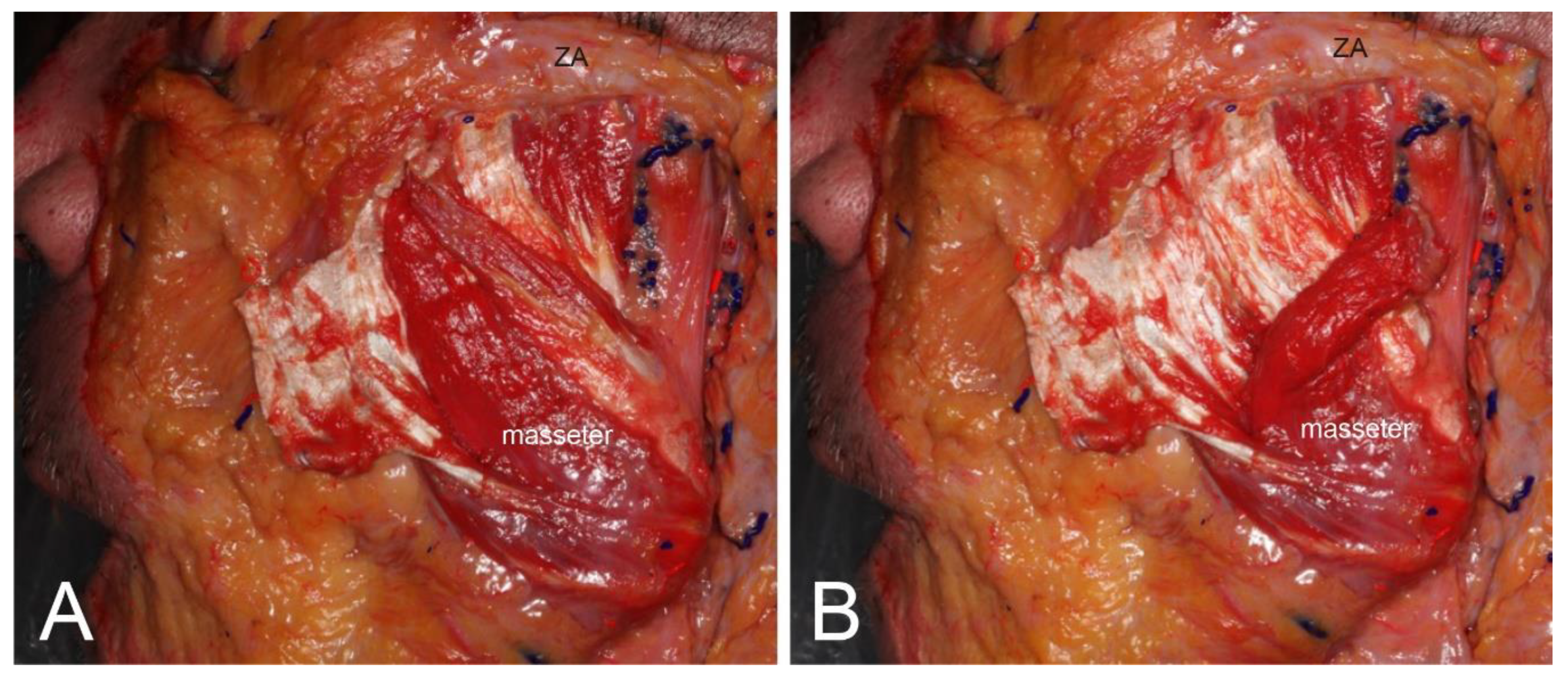 Toxins 12 00202 g002