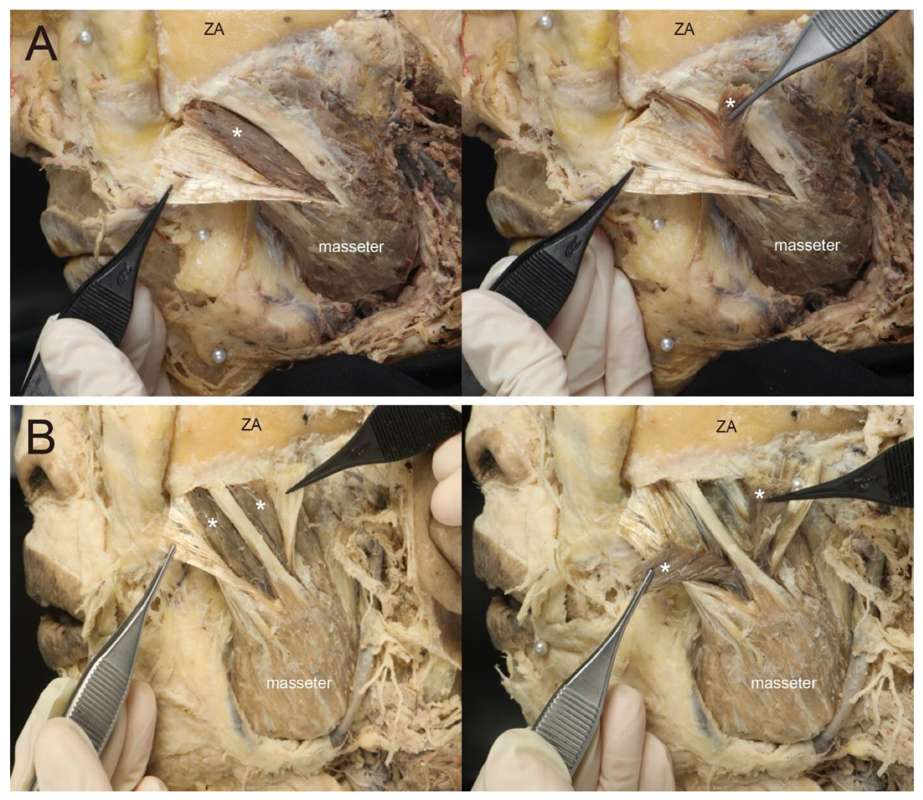 Toxins 12 00202 g003