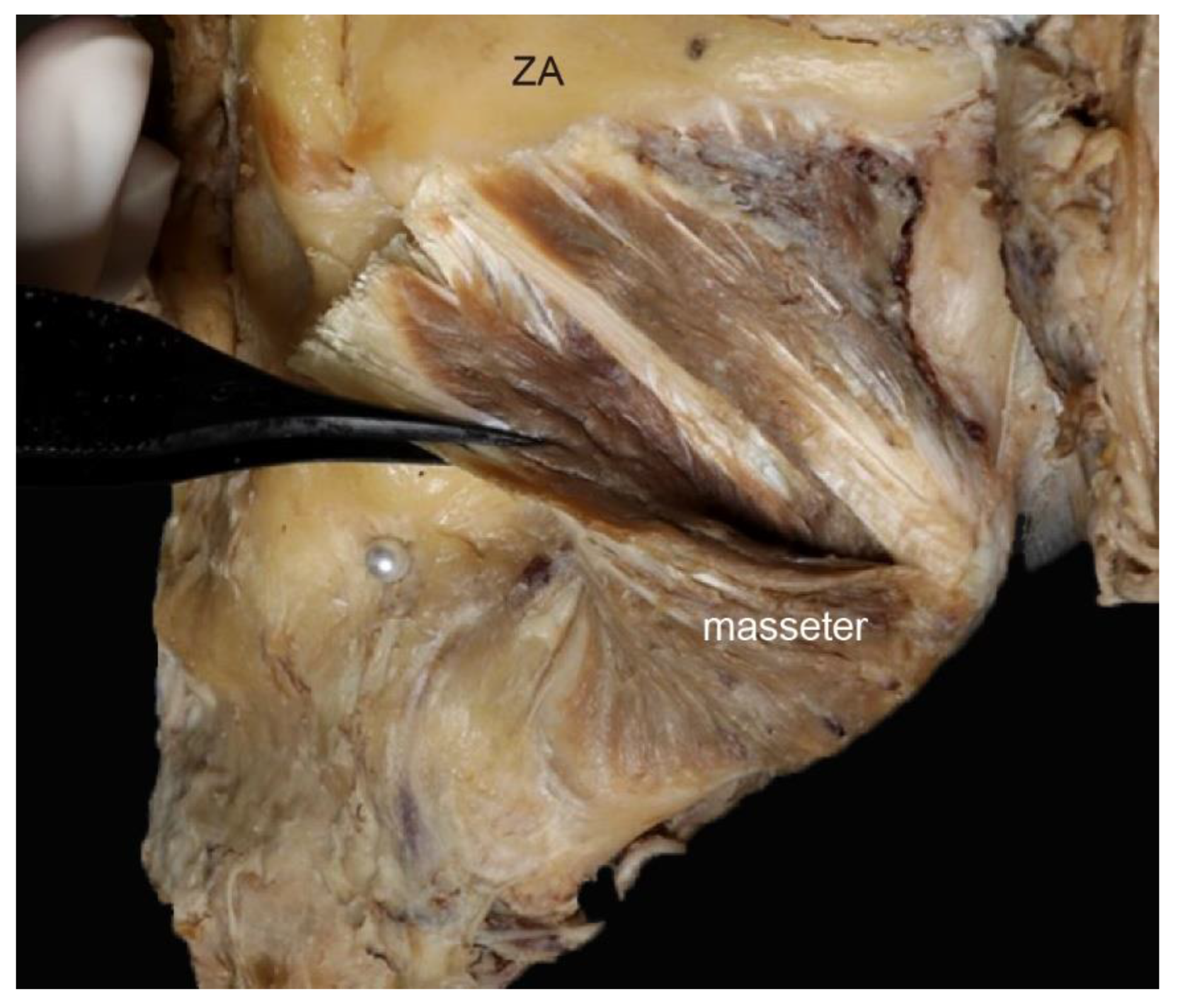 Toxins 12 00202 g004