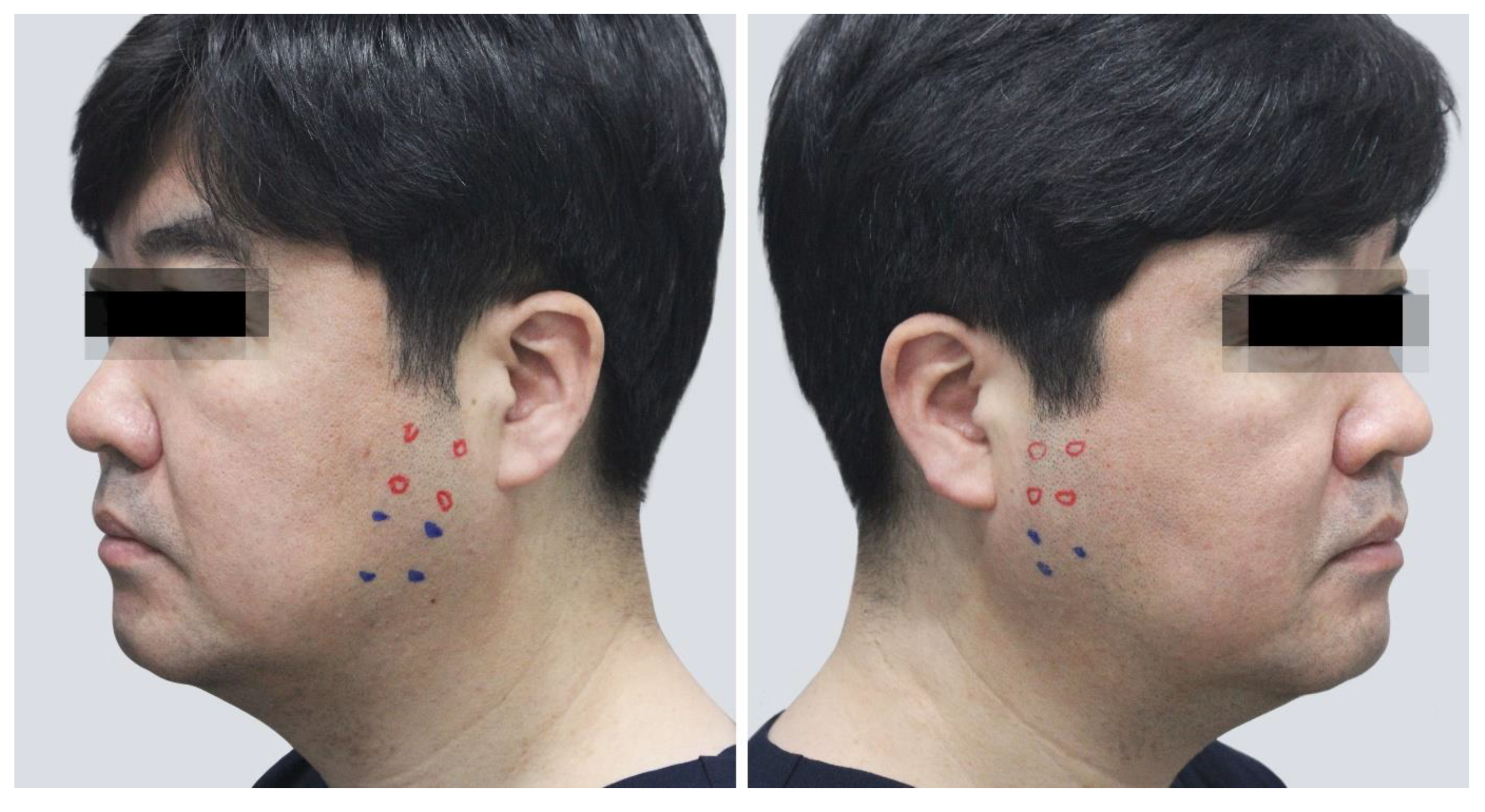 Toxins 12 00202 g007