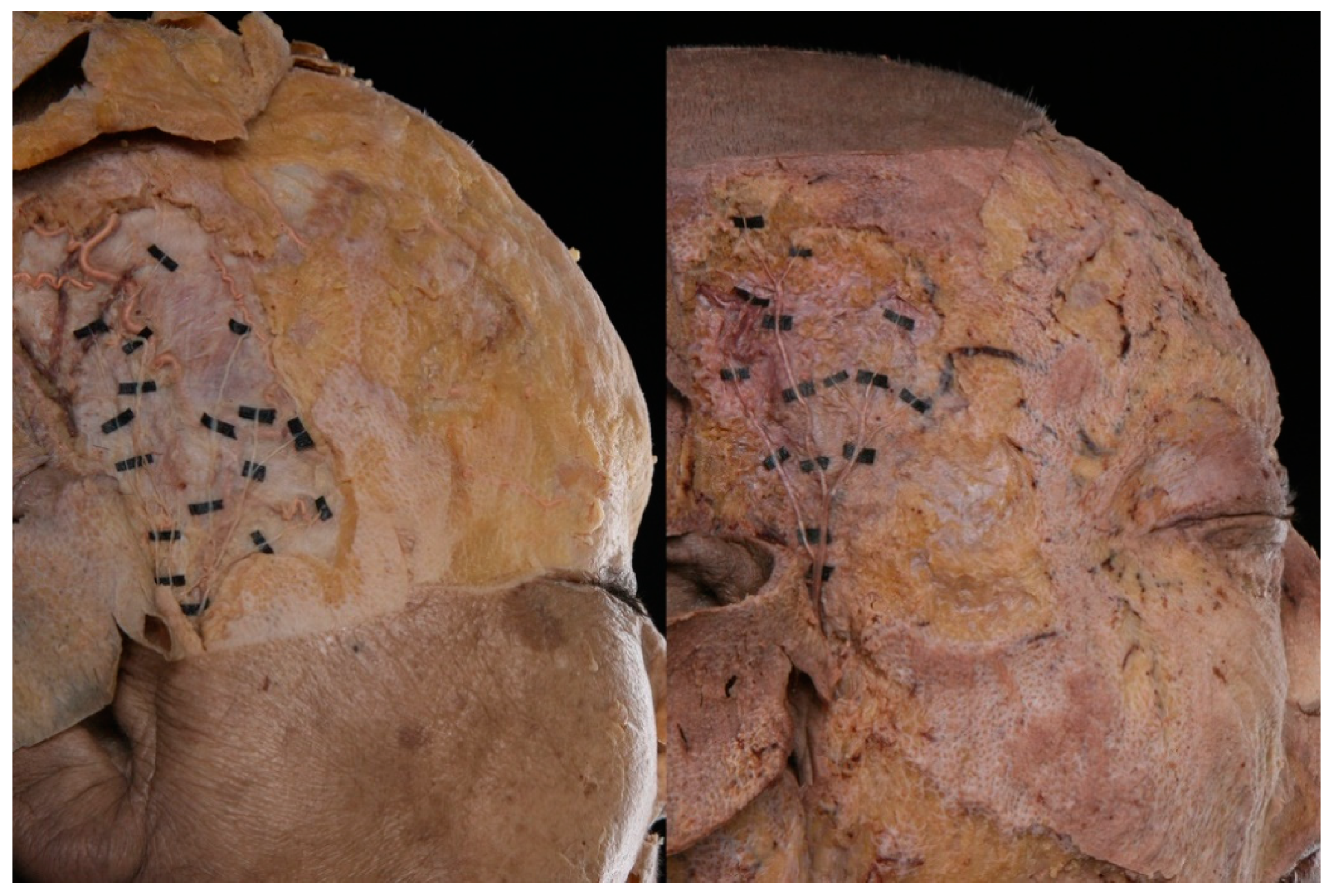 Toxins 12 00214 g001