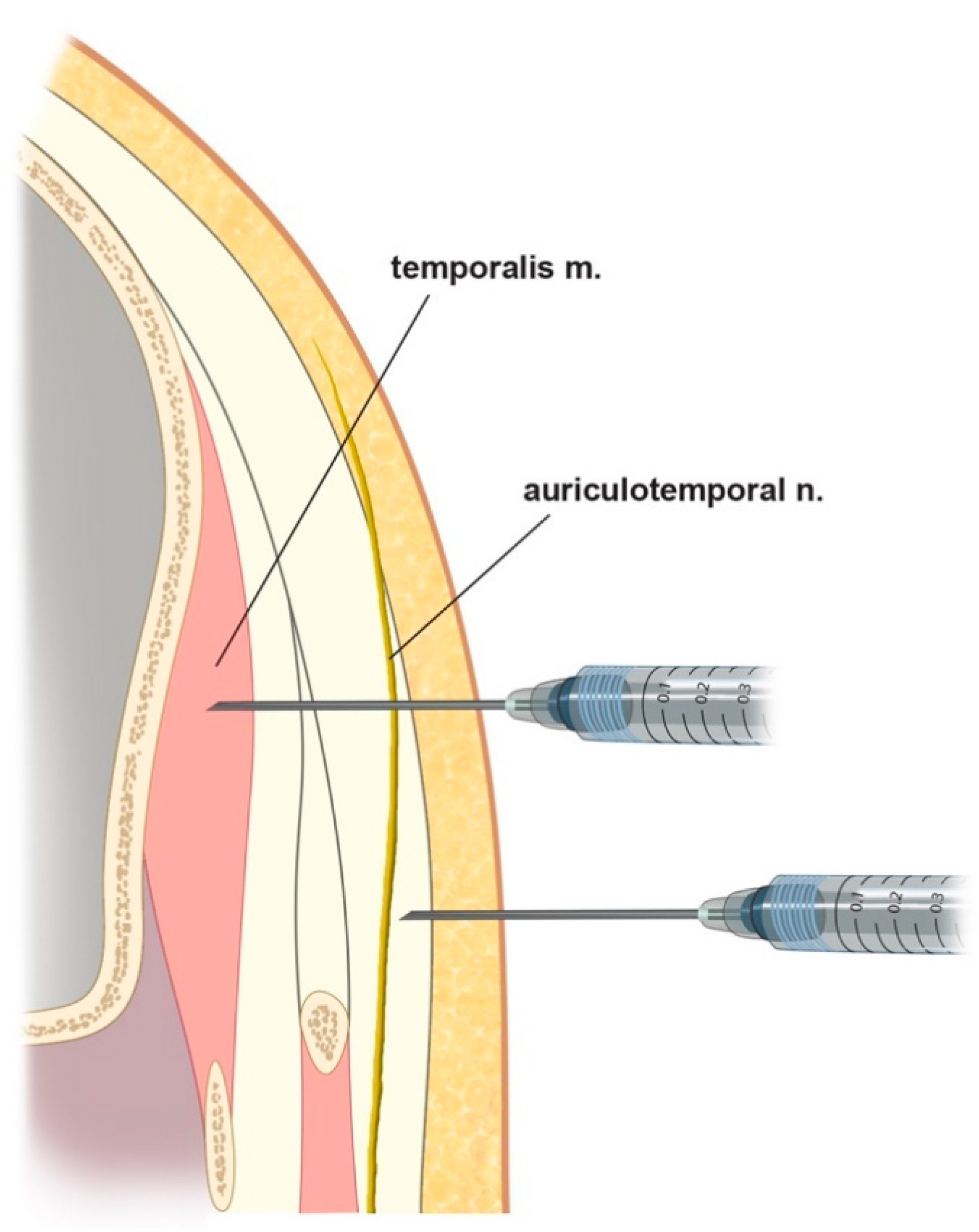 Toxins 12 00214 g003