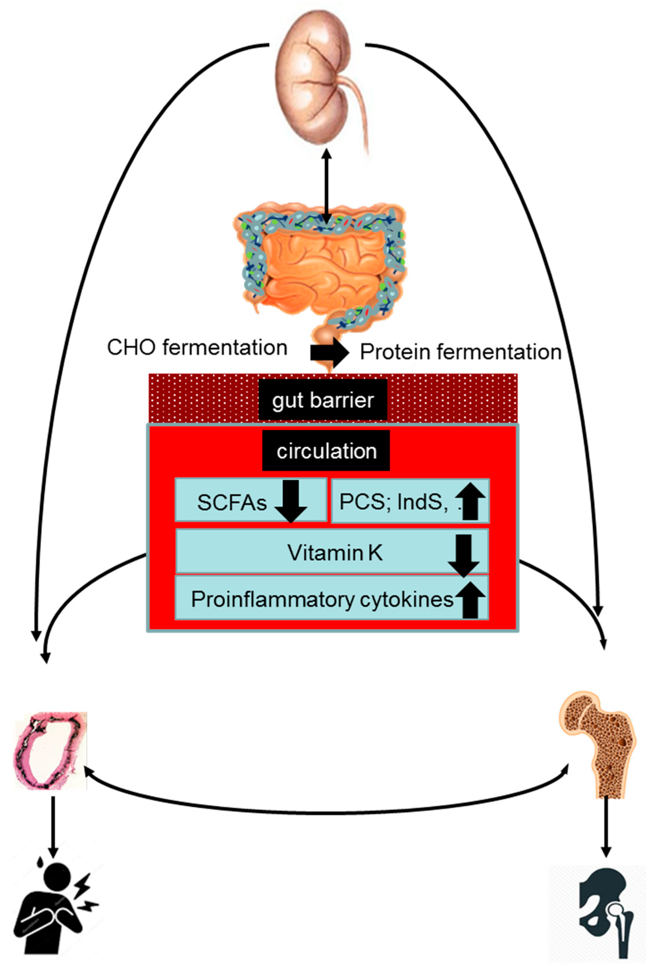 Toxins | Free Full-Text | The Role of Gut Dysbiosis in the Bone–Vascular  Axis in Chronic Kidney Disease