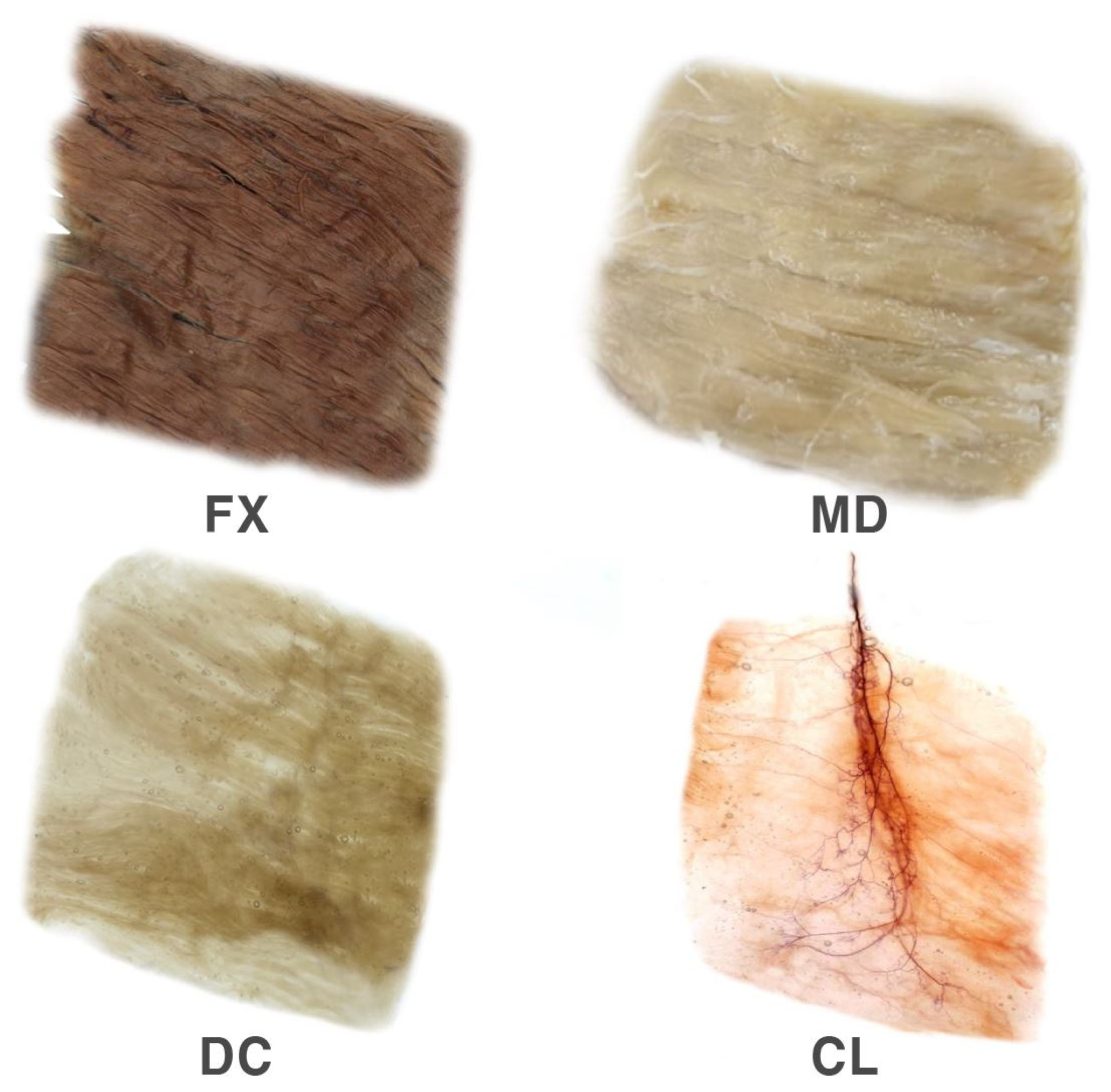 Toxins 12 00289 g004 Toxins 12 00289 g004